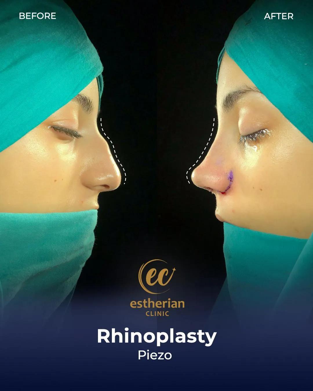 Estherian Clinic Istanbul results3