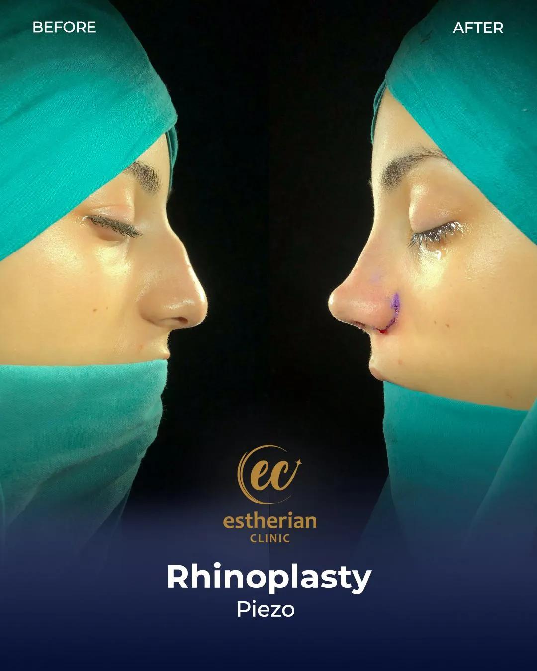 Estherian Clinic Istanbul results2