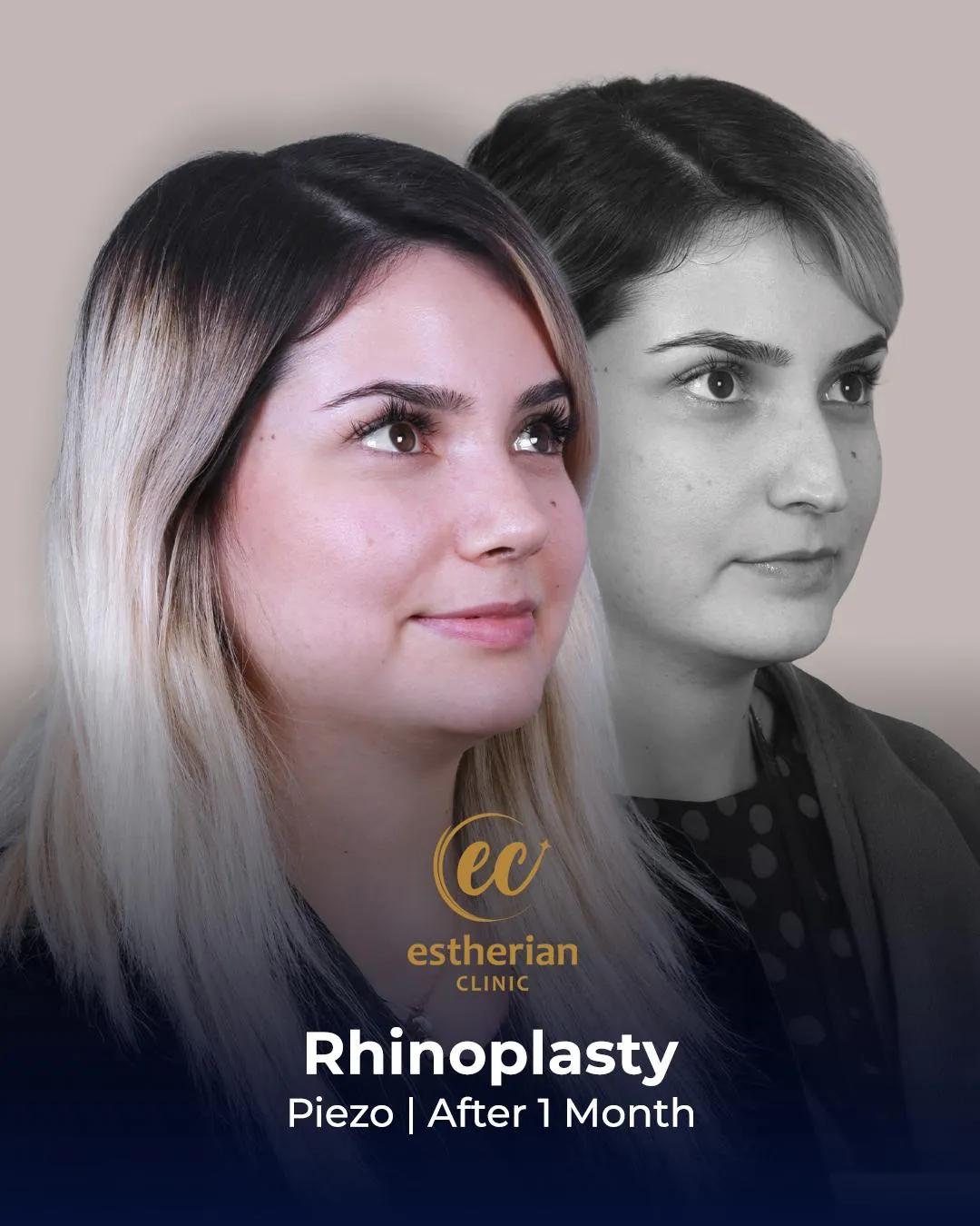 Estherian Clinic Istanbul results8