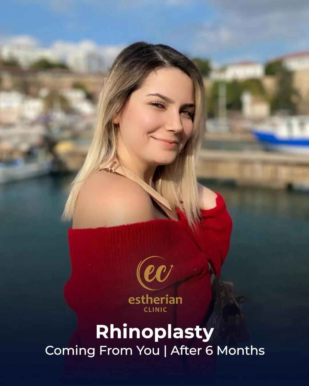 Estherian Clinic Istanbul results7