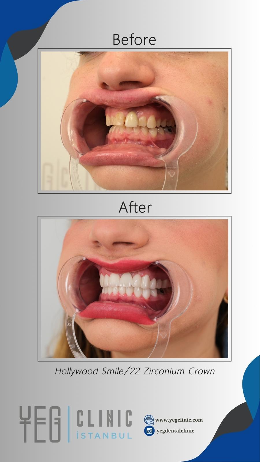 Yeg clinic dental istanbul 