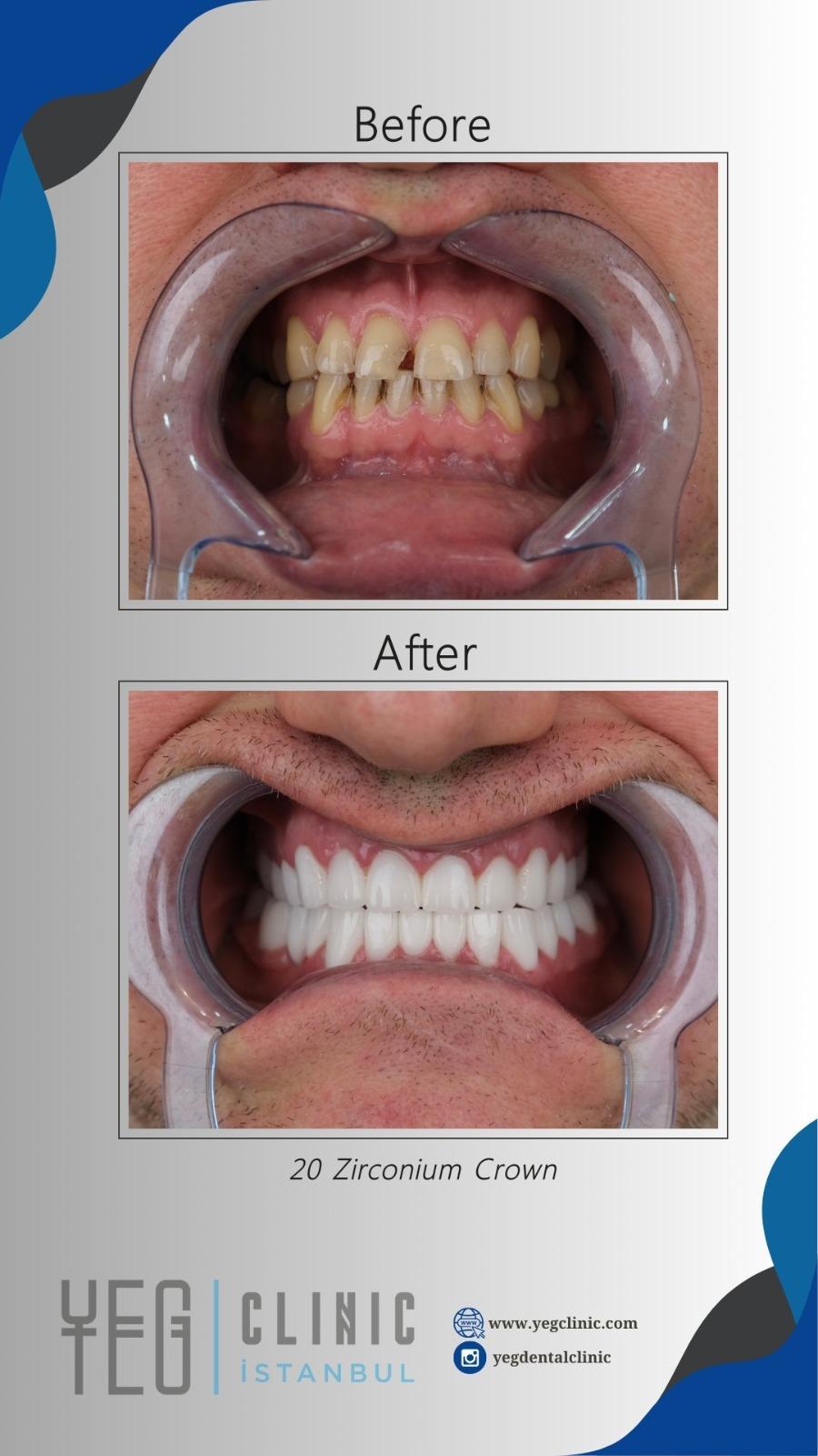 Yeg clinic dental istanbul 