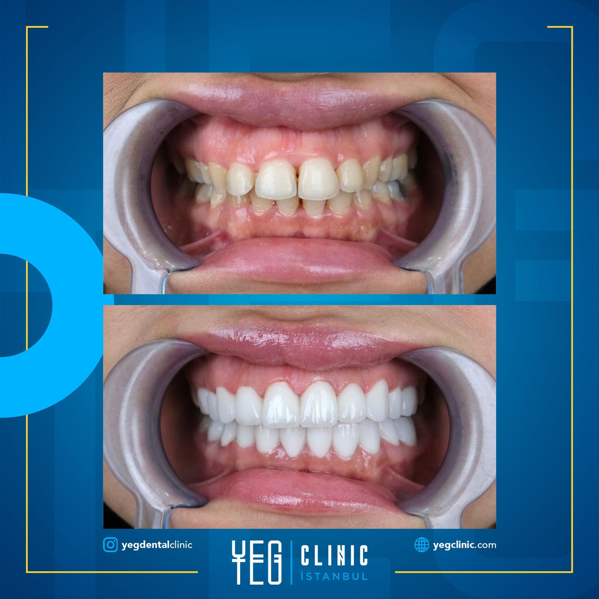 Yeg clinic dental istanbul 