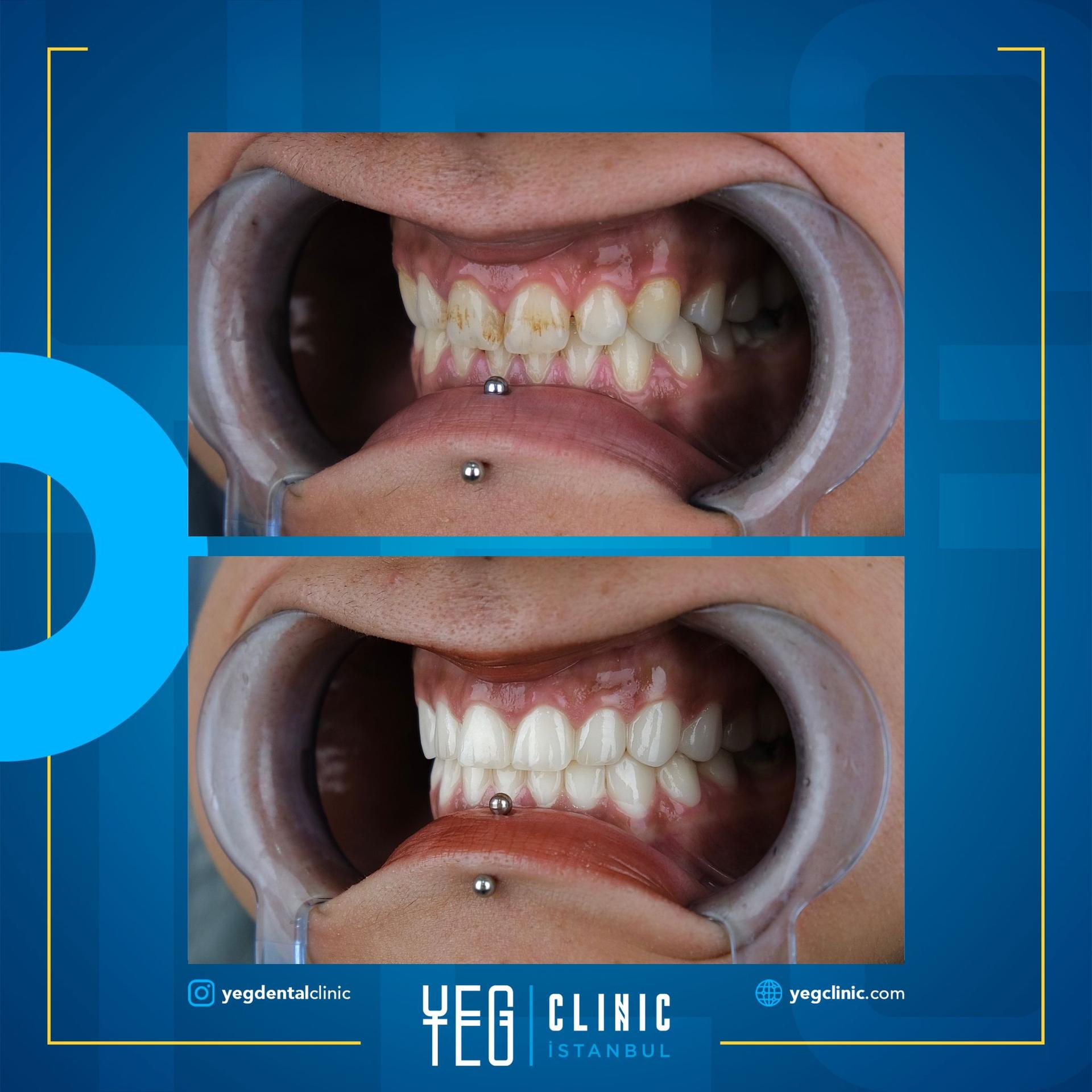 Yeg clinic dental istanbul 