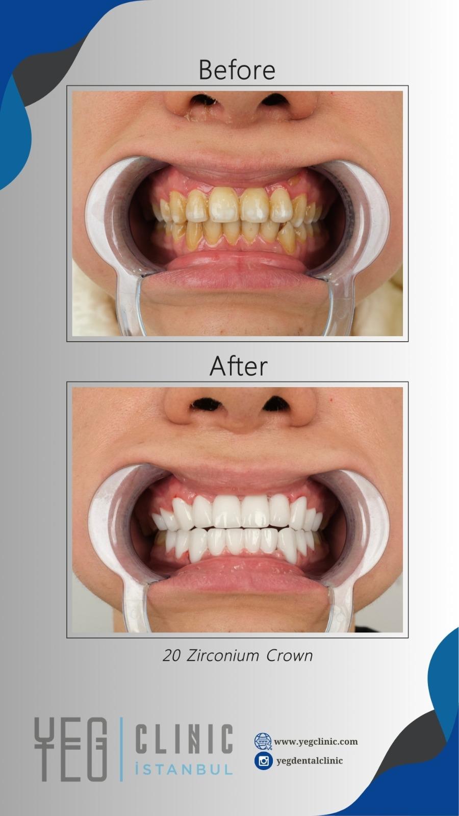 Yeg clinic dental istanbul 