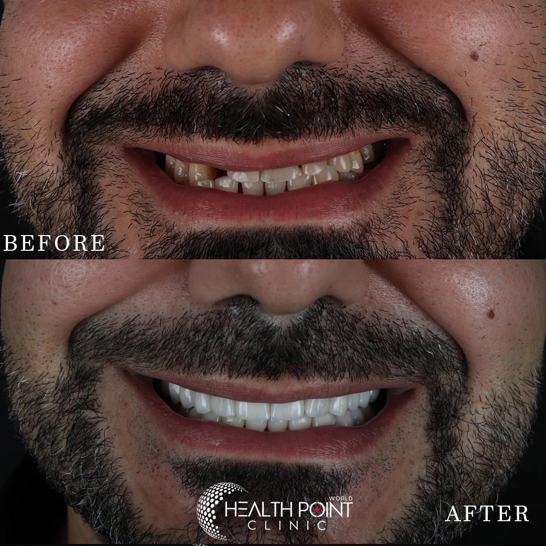 WhatsApp Image 2025-02-11 at 17.13.02(1)