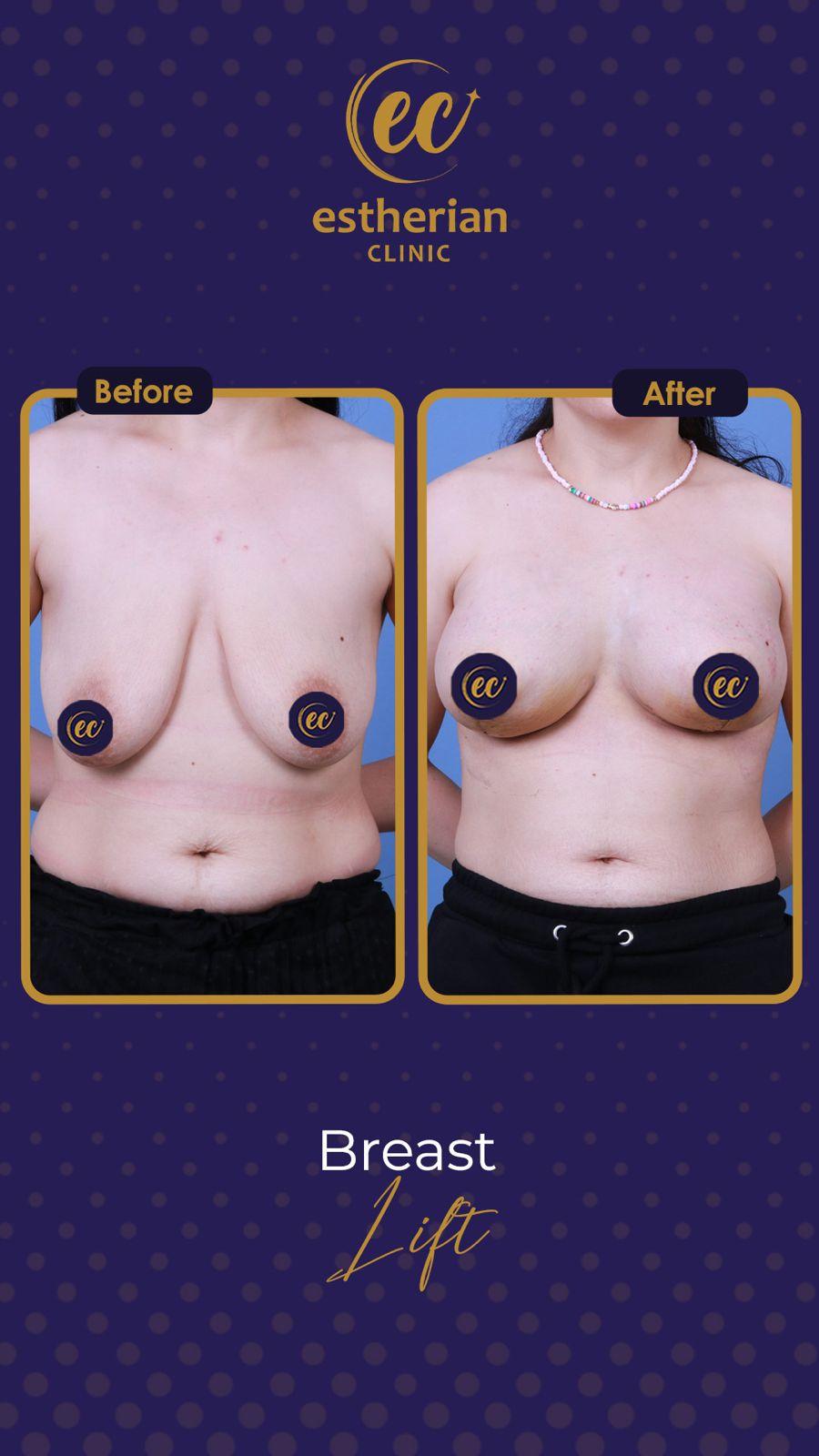 Estherian Istanbul on Esthetic Planet