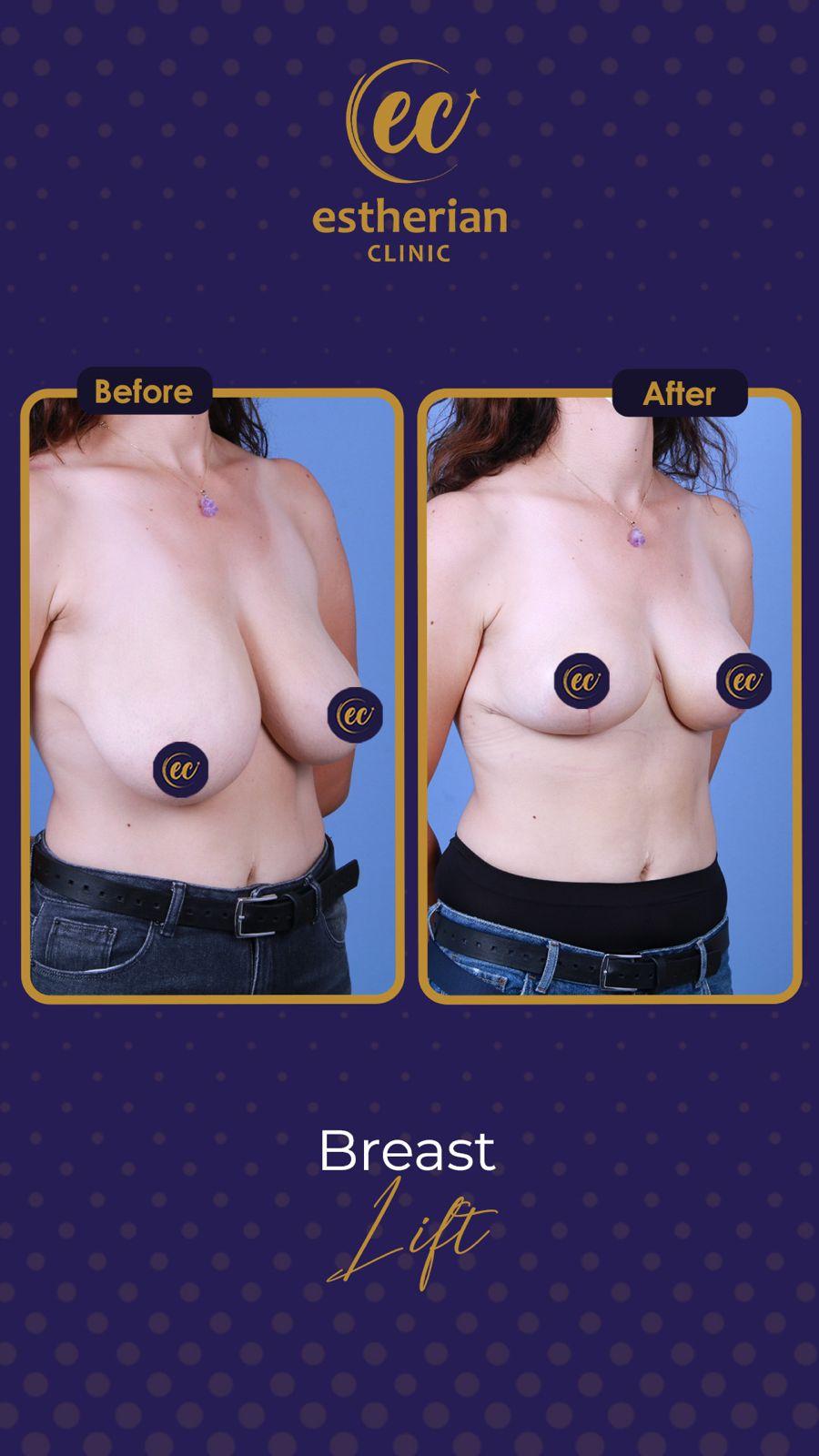 Estherian Istanbul on Esthetic Planet