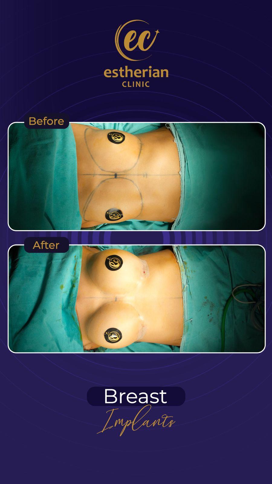 Estherian Istanbul on Esthetic Planet