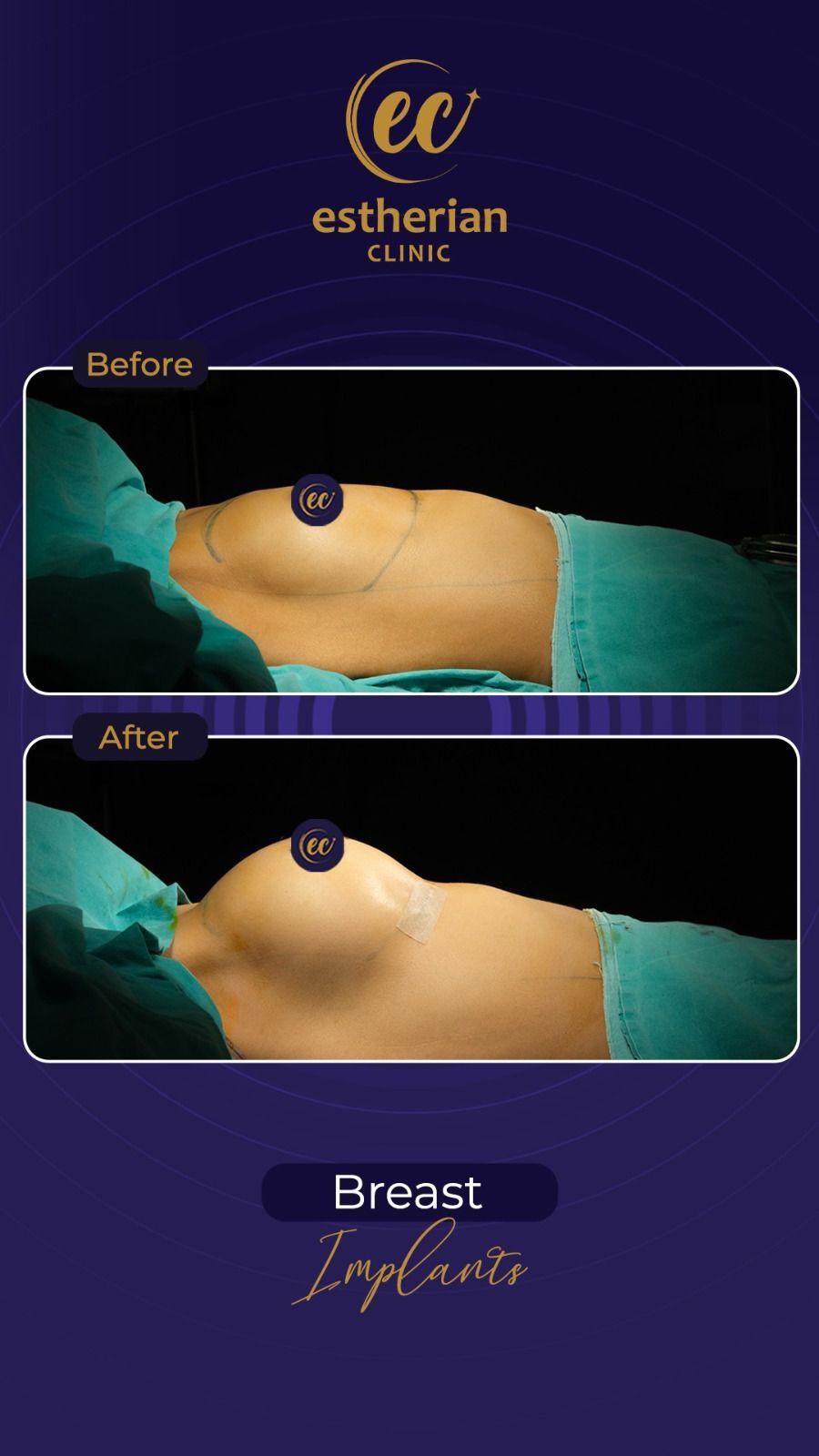 Estherian Istanbul on Esthetic Planet