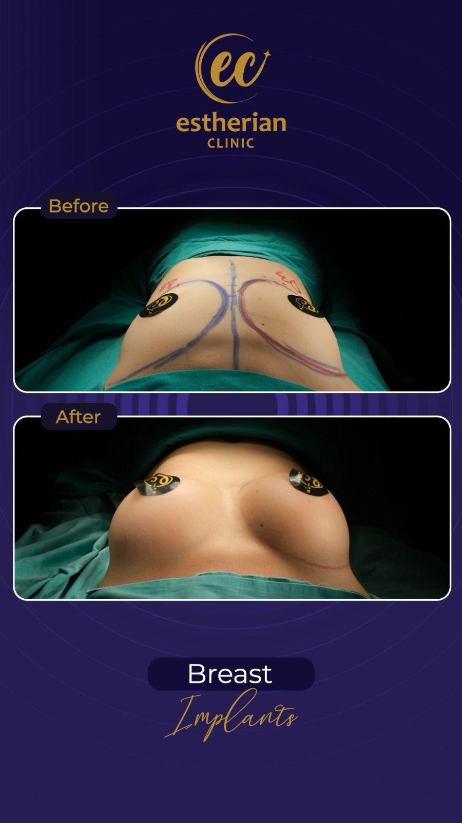 Estherian Istanbul on Esthetic Planet