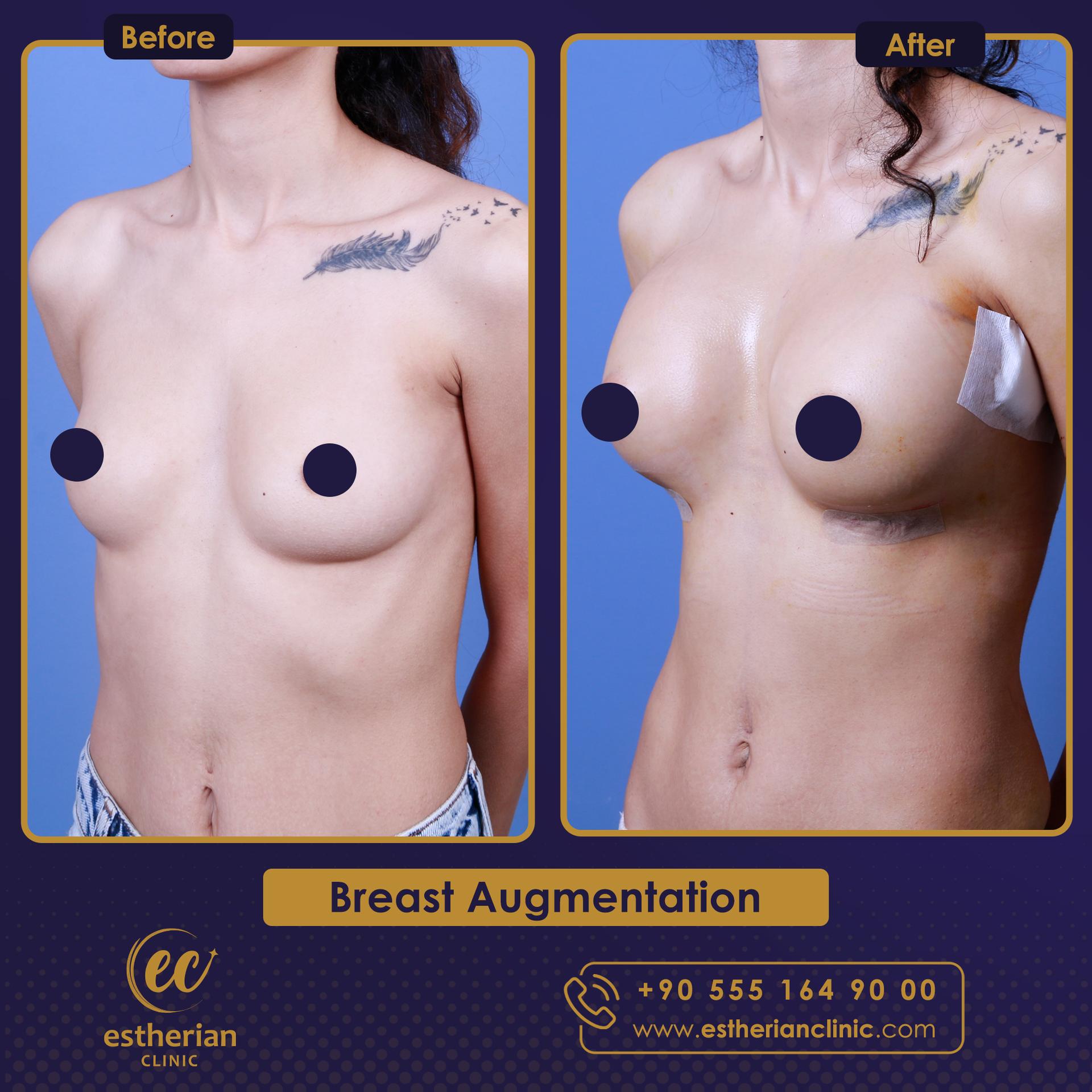 Estherian Istanbul on Esthetic Planet