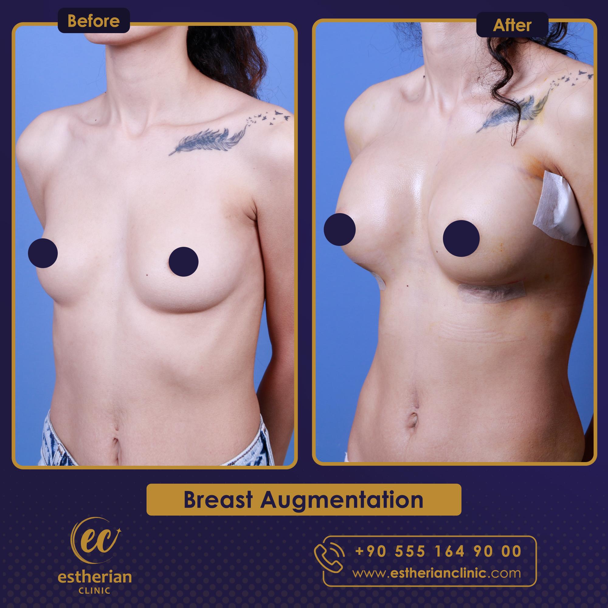 Estherian Istanbul on Esthetic Planet