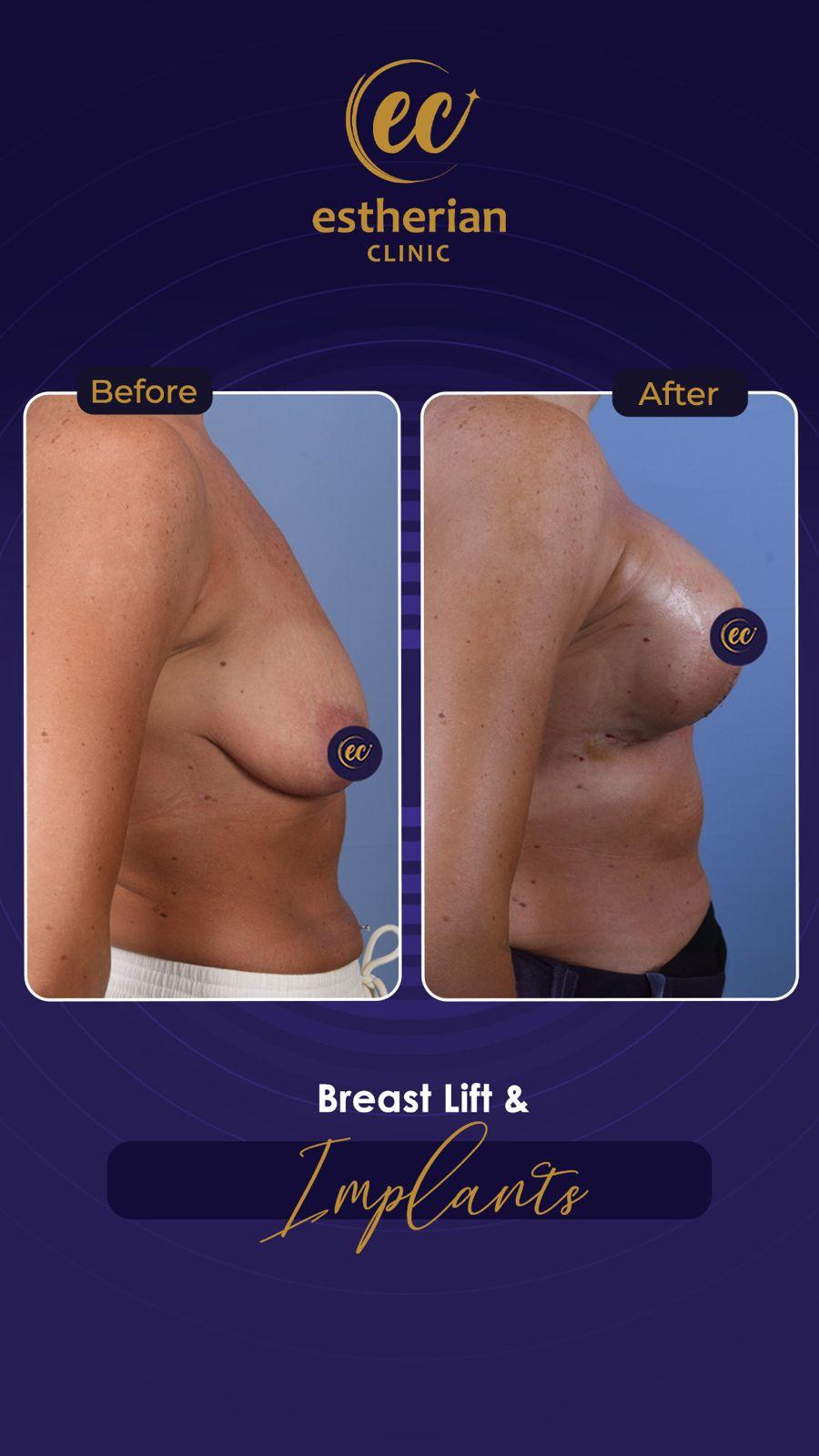 Estherian Istanbul on Esthetic Planet