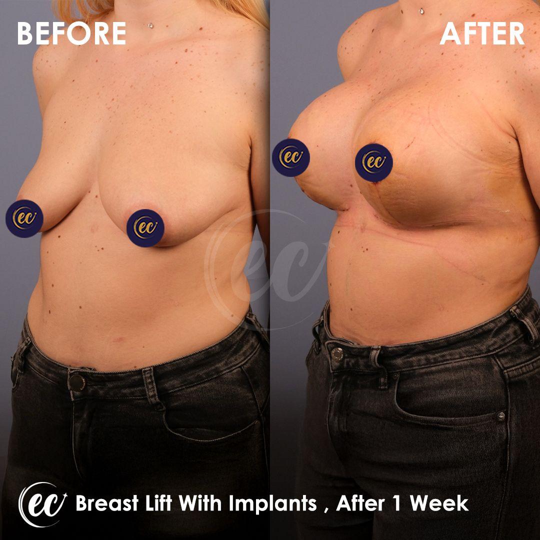 Estherian Istanbul on Esthetic Planet