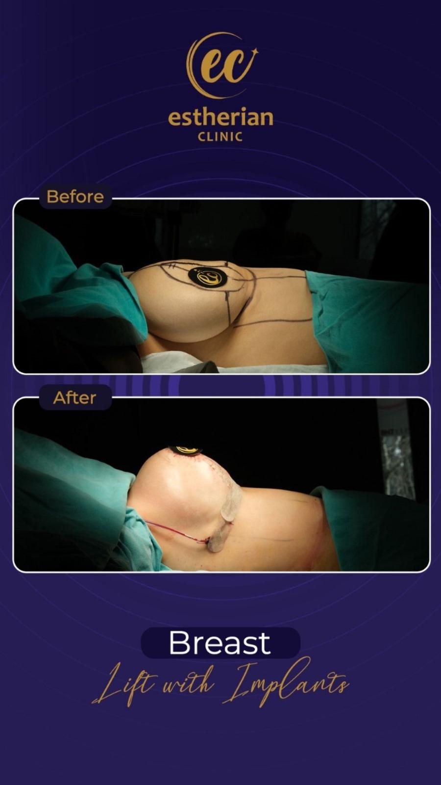 Estherian Istanbul on Esthetic Planet