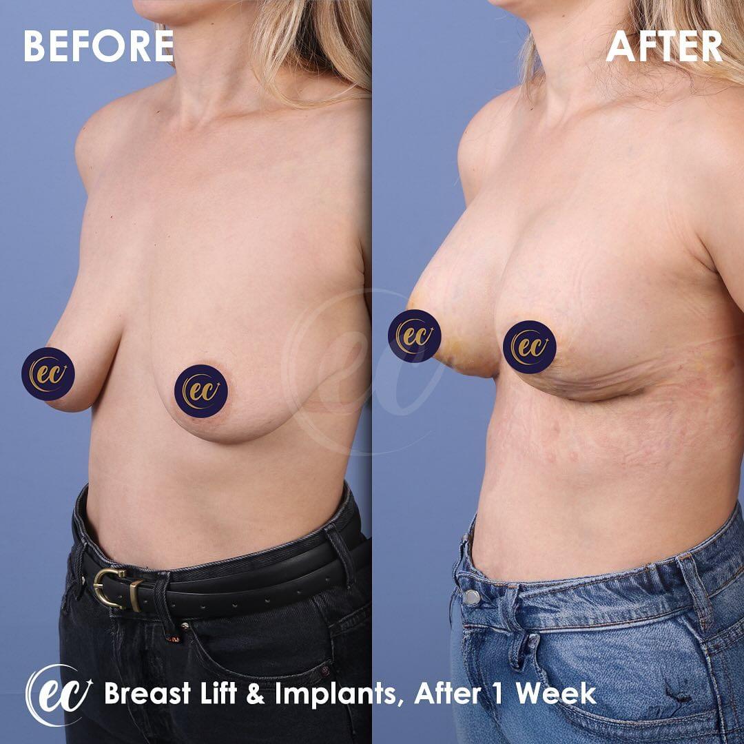 Estherian Istanbul on Esthetic Planet