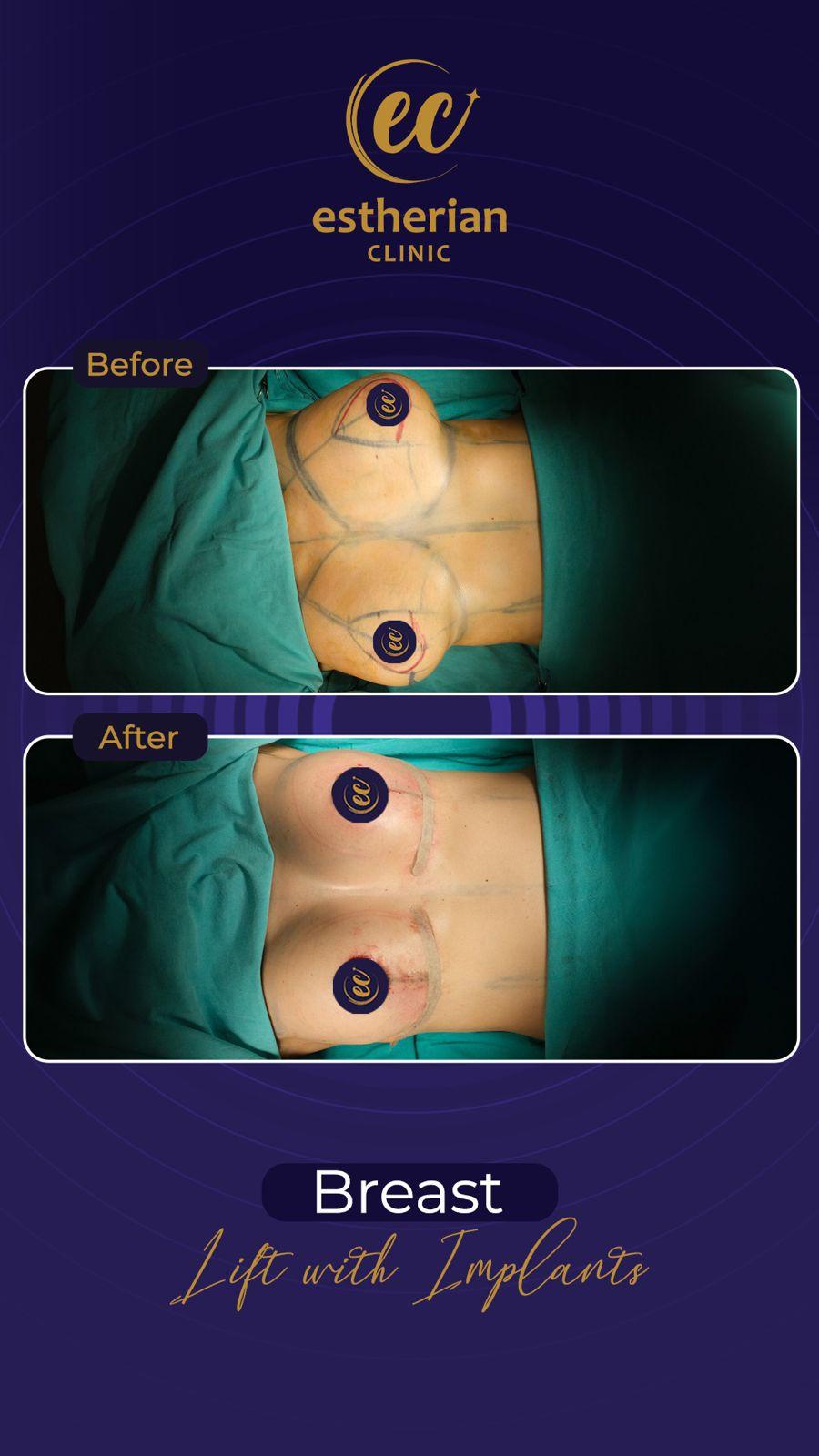 Estherian Istanbul on Esthetic Planet