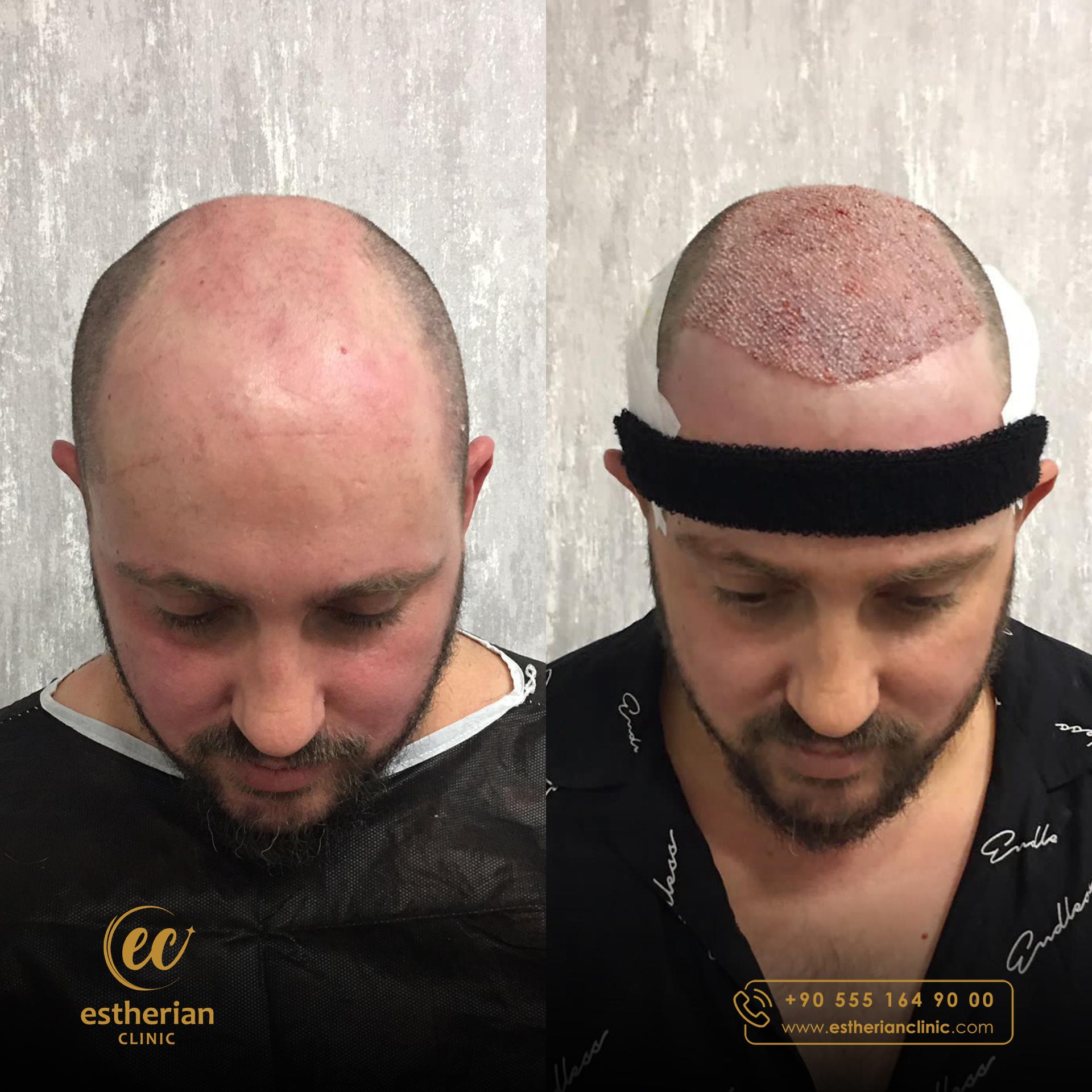 Estherian Istanbul on Esthetic Planet