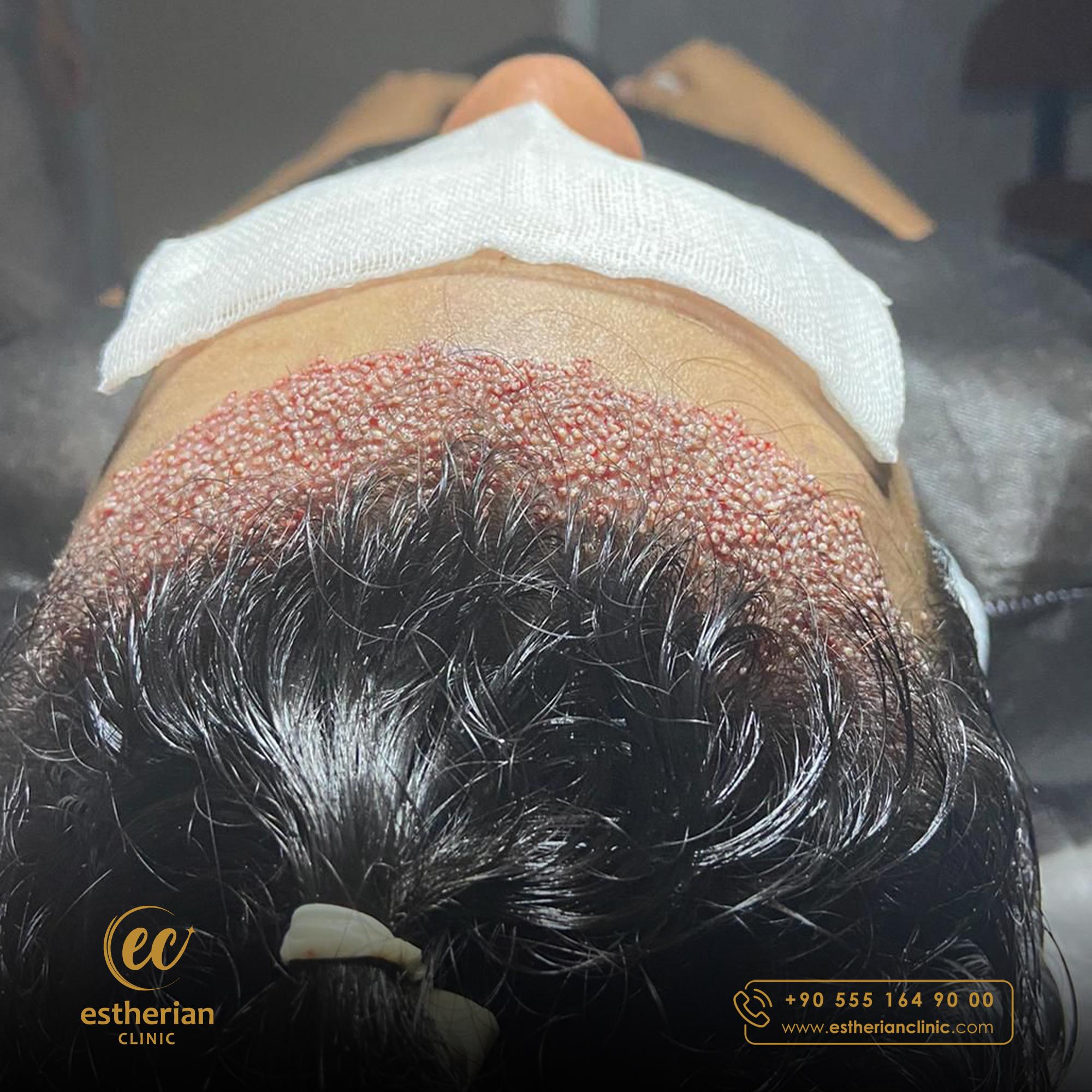 Estherian Istanbul on Esthetic Planet