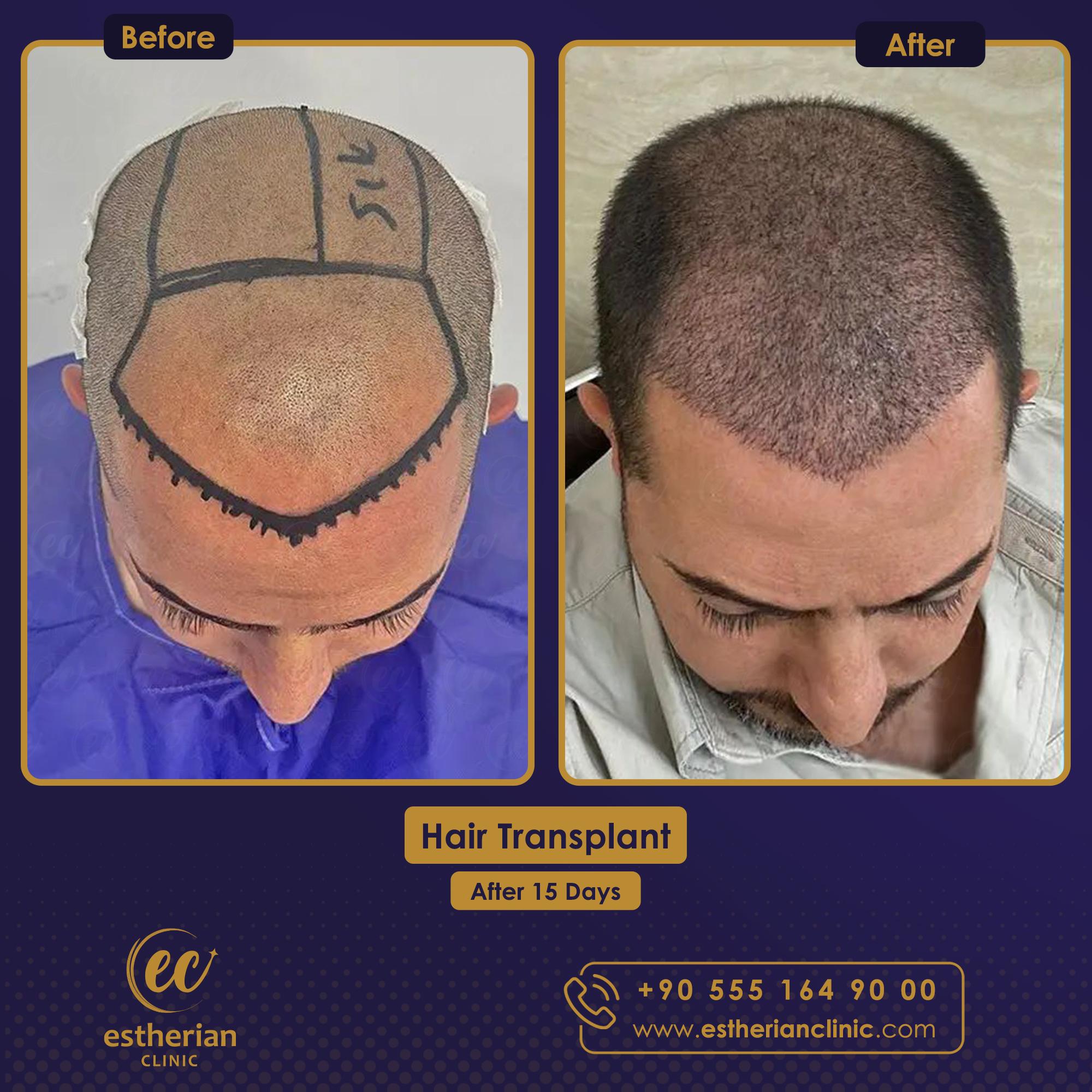 Estherian Istanbul on Esthetic Planet