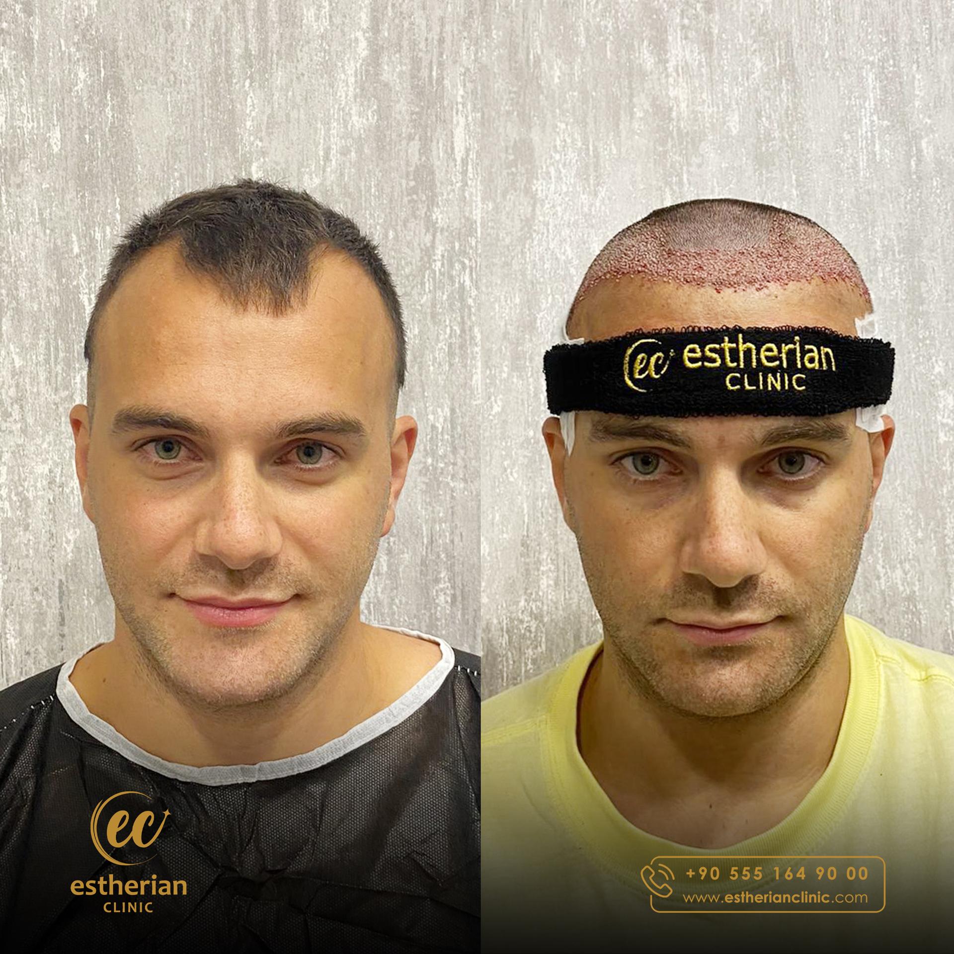 Estherian Istanbul on Esthetic Planet