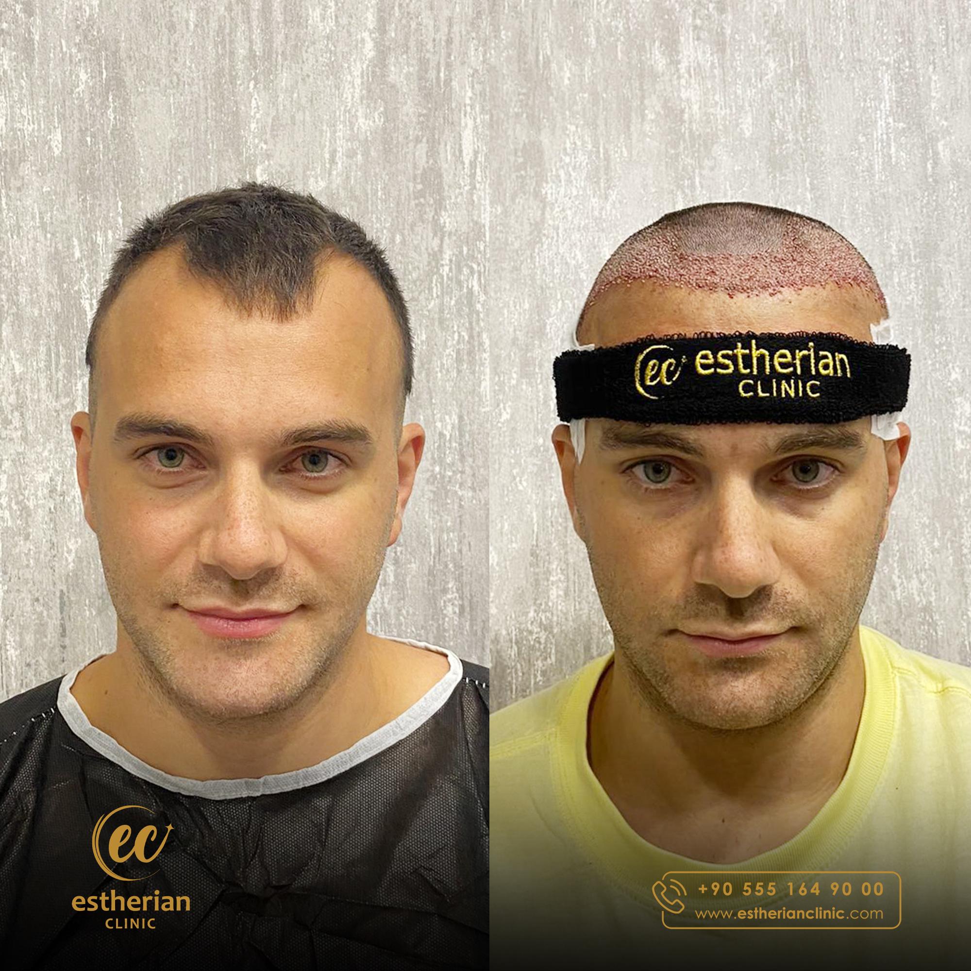 Estherian Istanbul on Esthetic Planet