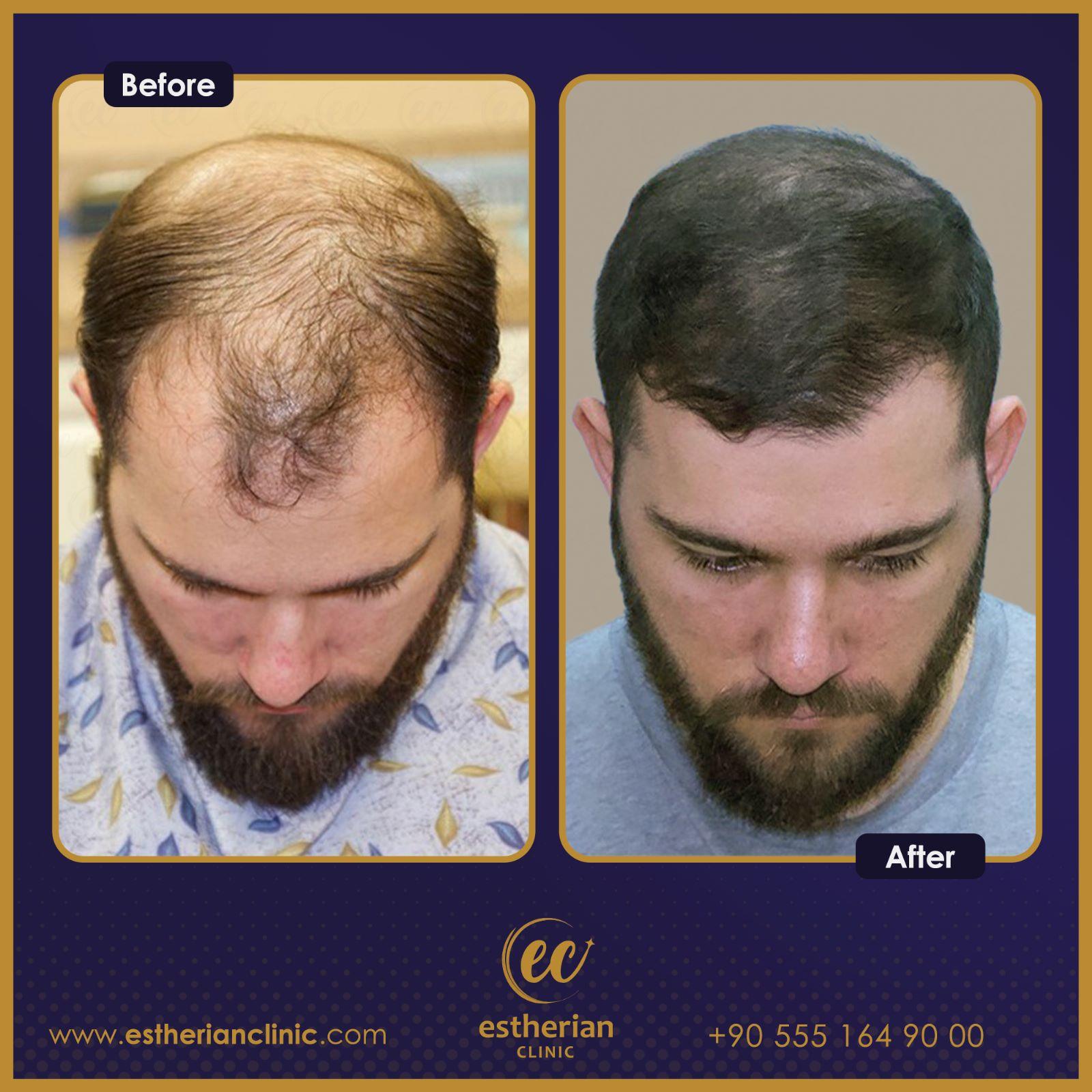 Estherian Istanbul on Esthetic Planet