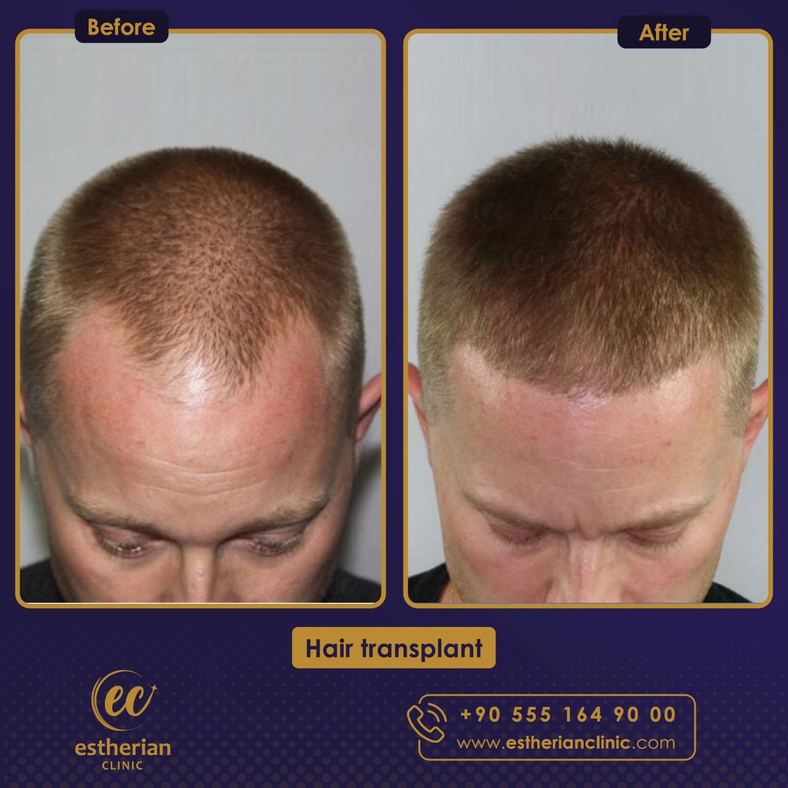 WhatsApp Image 2023-08-17 at 19.07.50