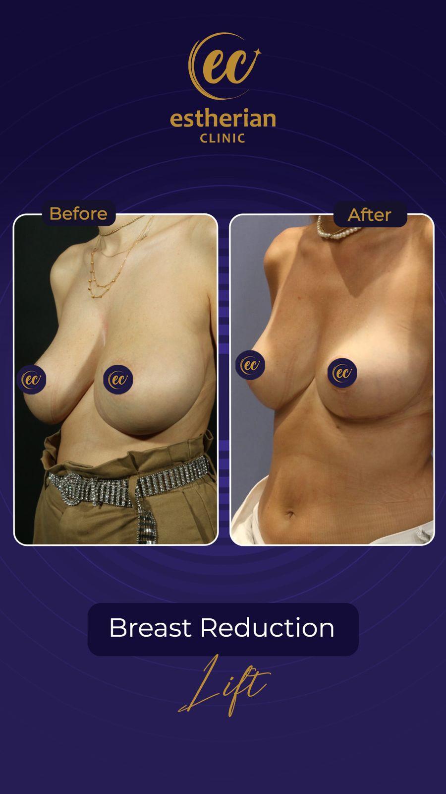 Estherian Istanbul on Esthetic Planet