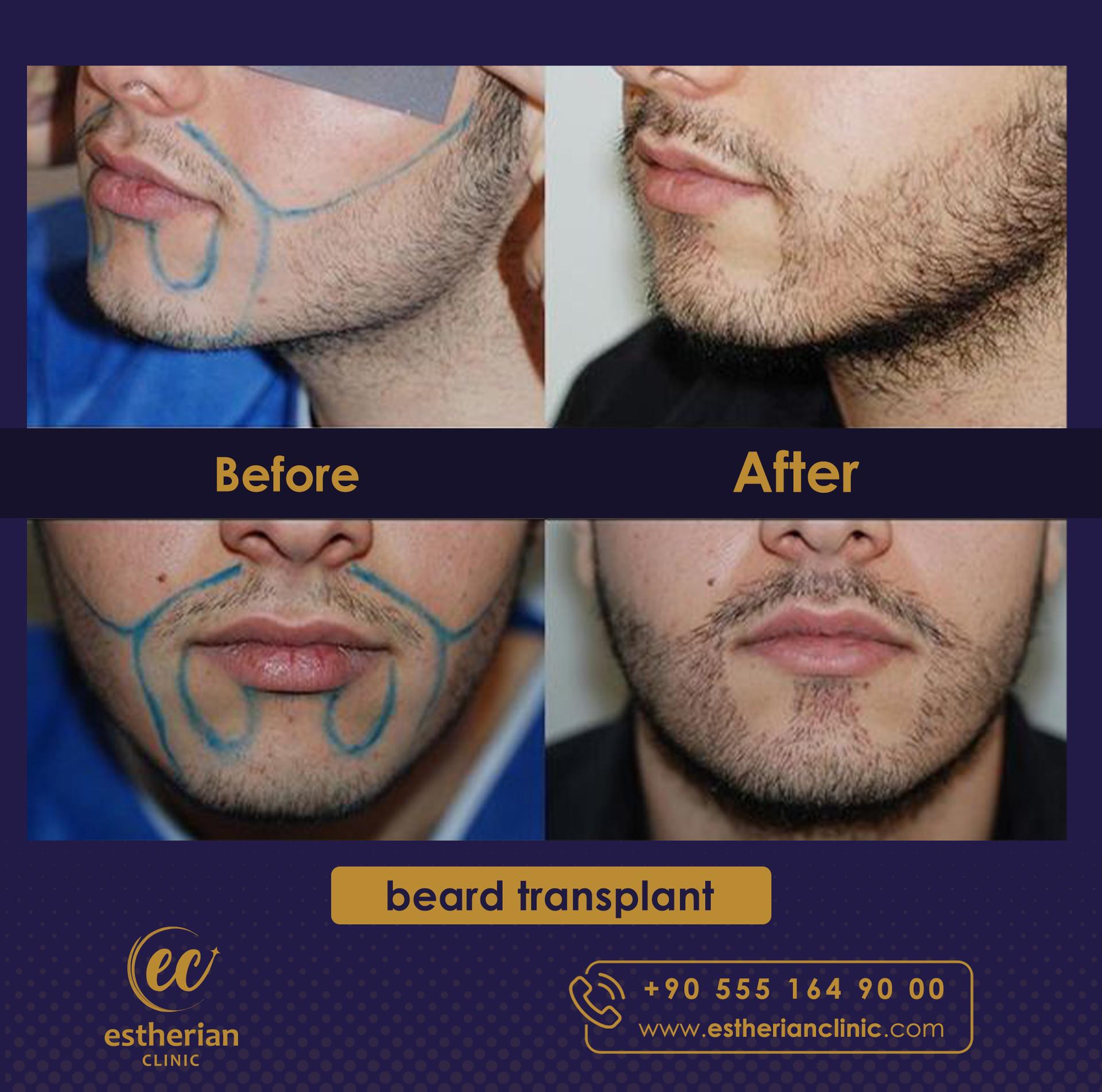 Estherian Istanbul on Esthetic Planet