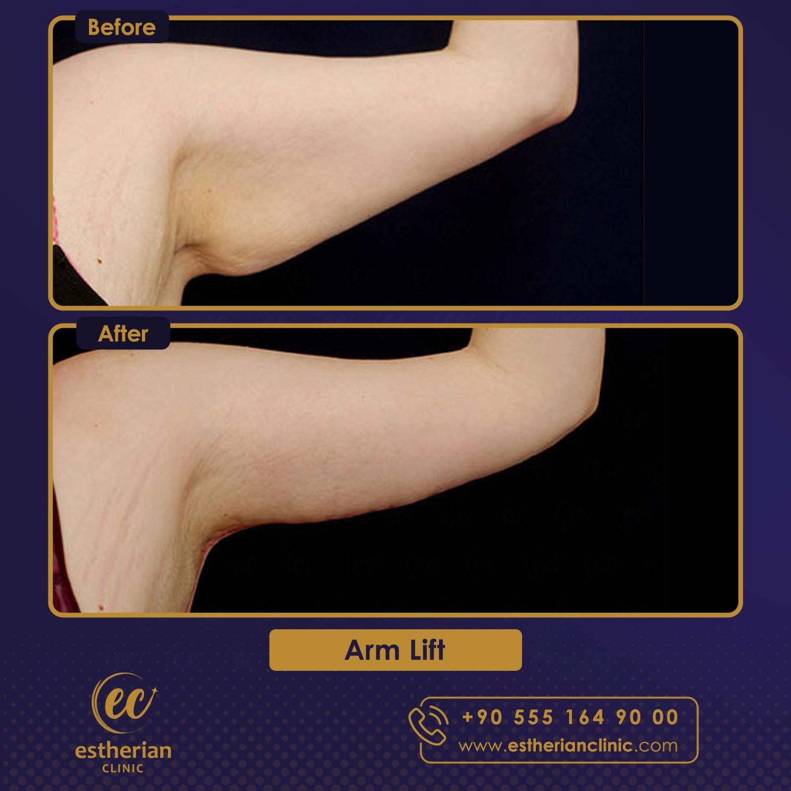 Estherian Istanbul on Esthetic Planet