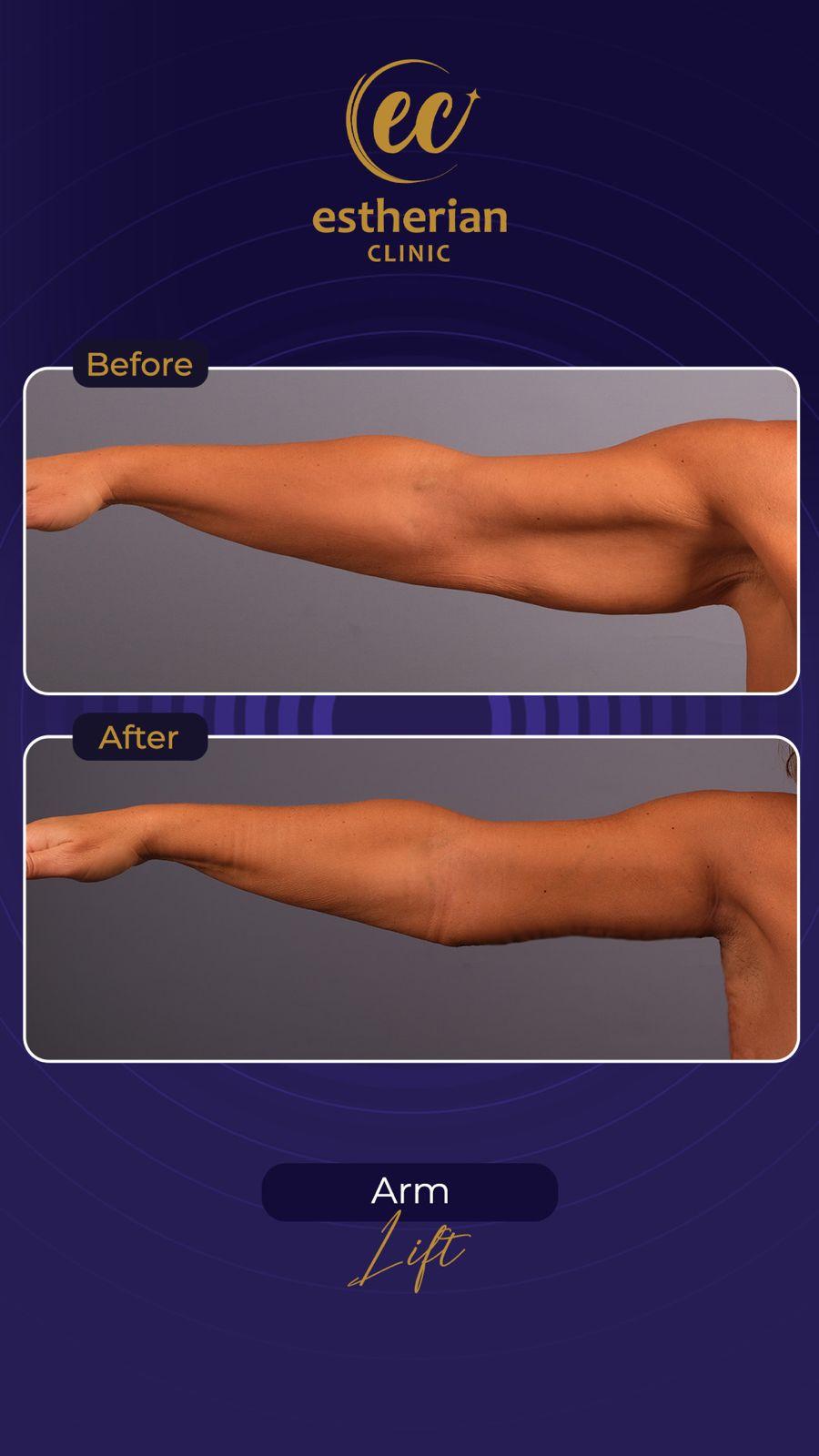 Estherian Istanbul on Esthetic Planet