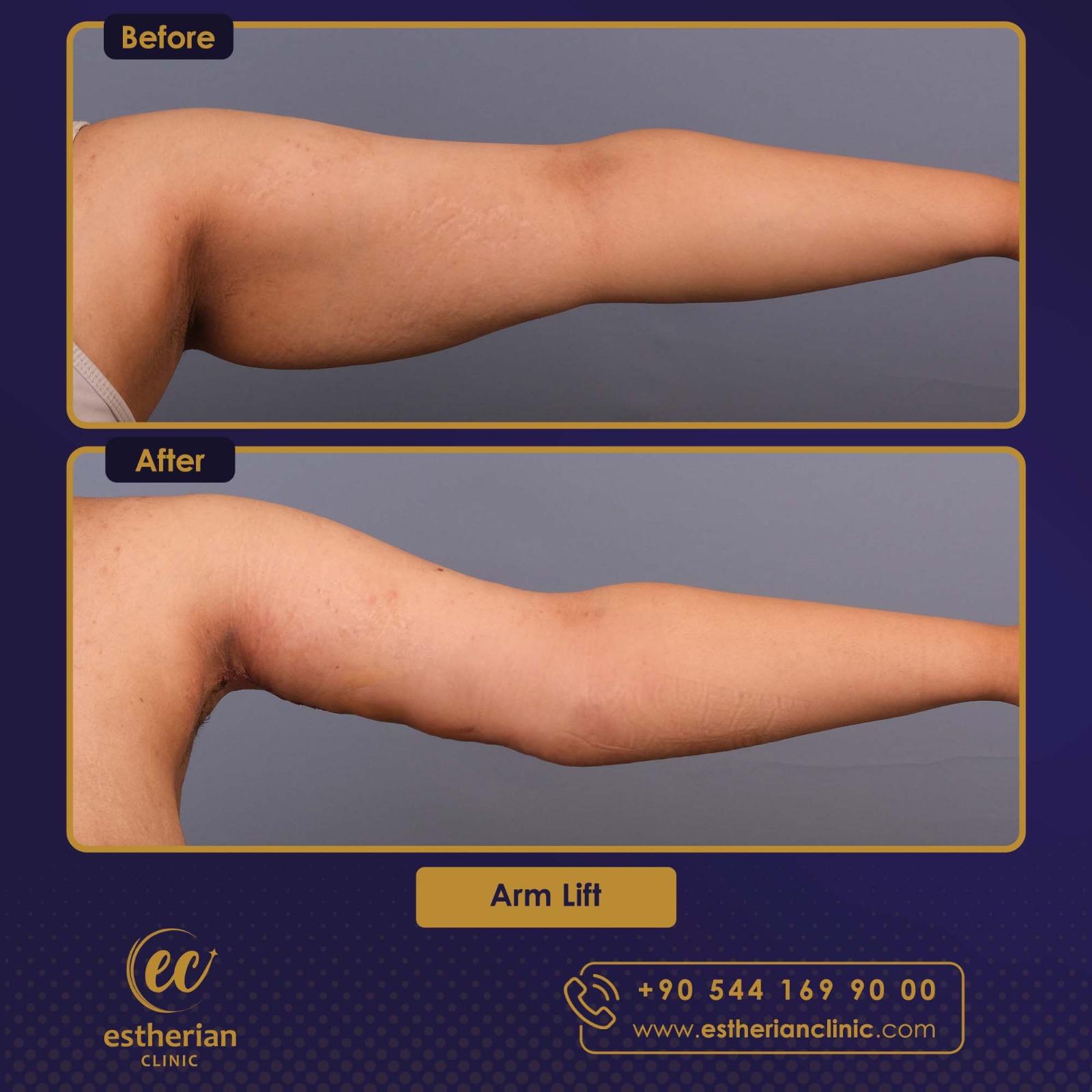 Estherian Istanbul on Esthetic Planet