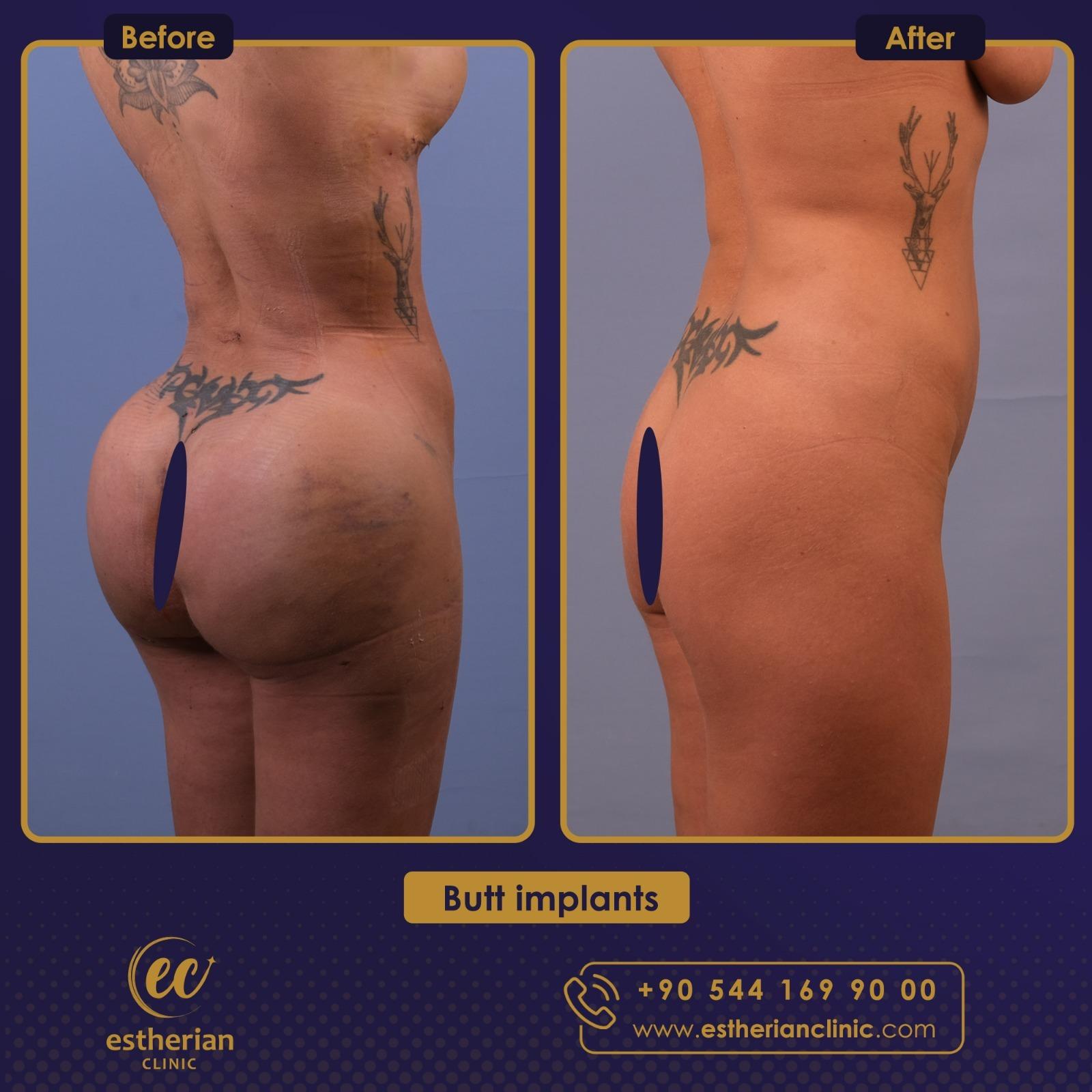 Estherian Istanbul on Esthetic Planet