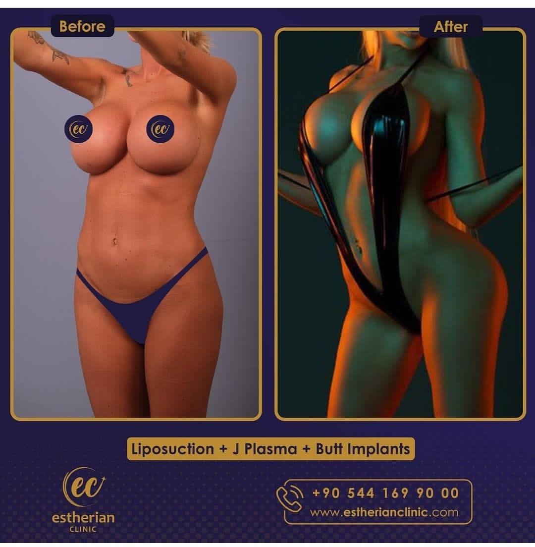 Estherian Istanbul on Esthetic Planet