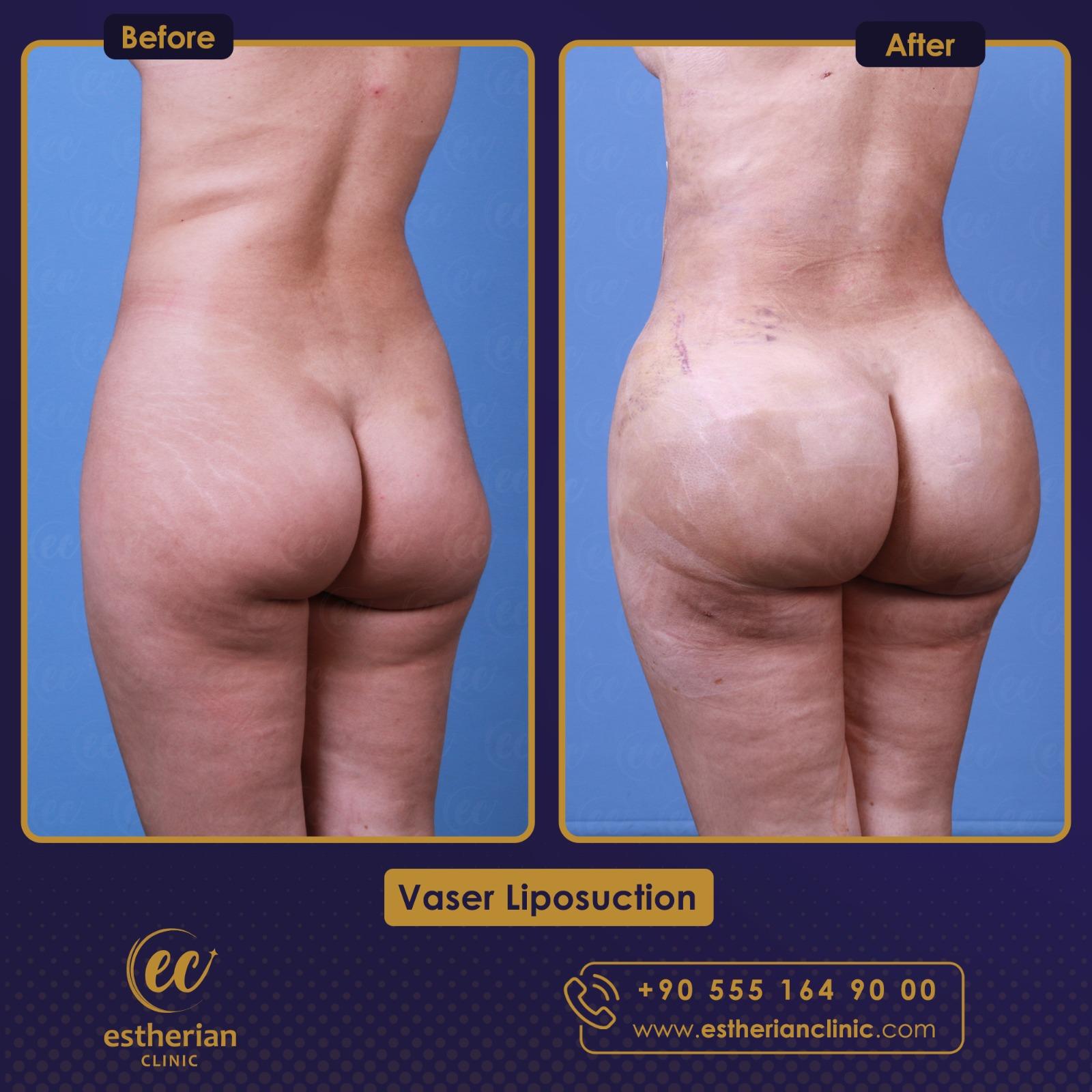 Estherian Istanbul on Esthetic Planet-20241028-WA0006