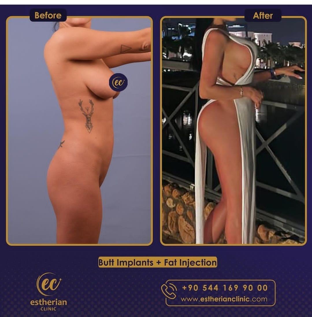 Estherian Istanbul on Esthetic Planet