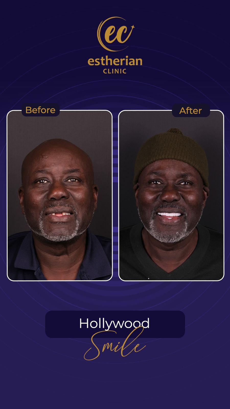 Estherian Istanbul on Esthetic Planet40522-WA0023