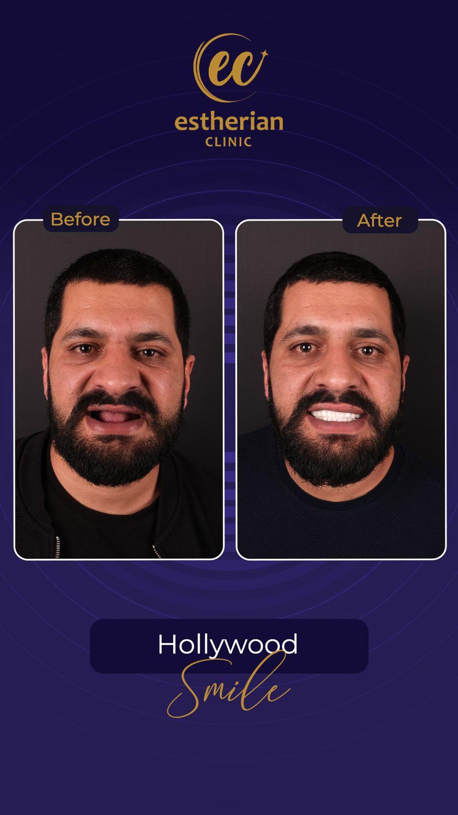 Estherian Istanbul on Esthetic Planet