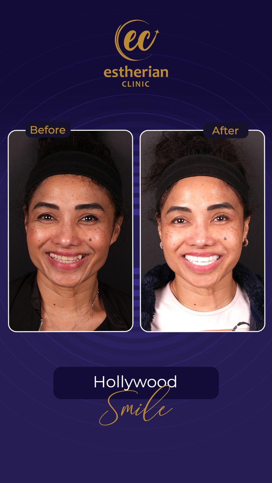 Estherian Istanbul on Esthetic Planet