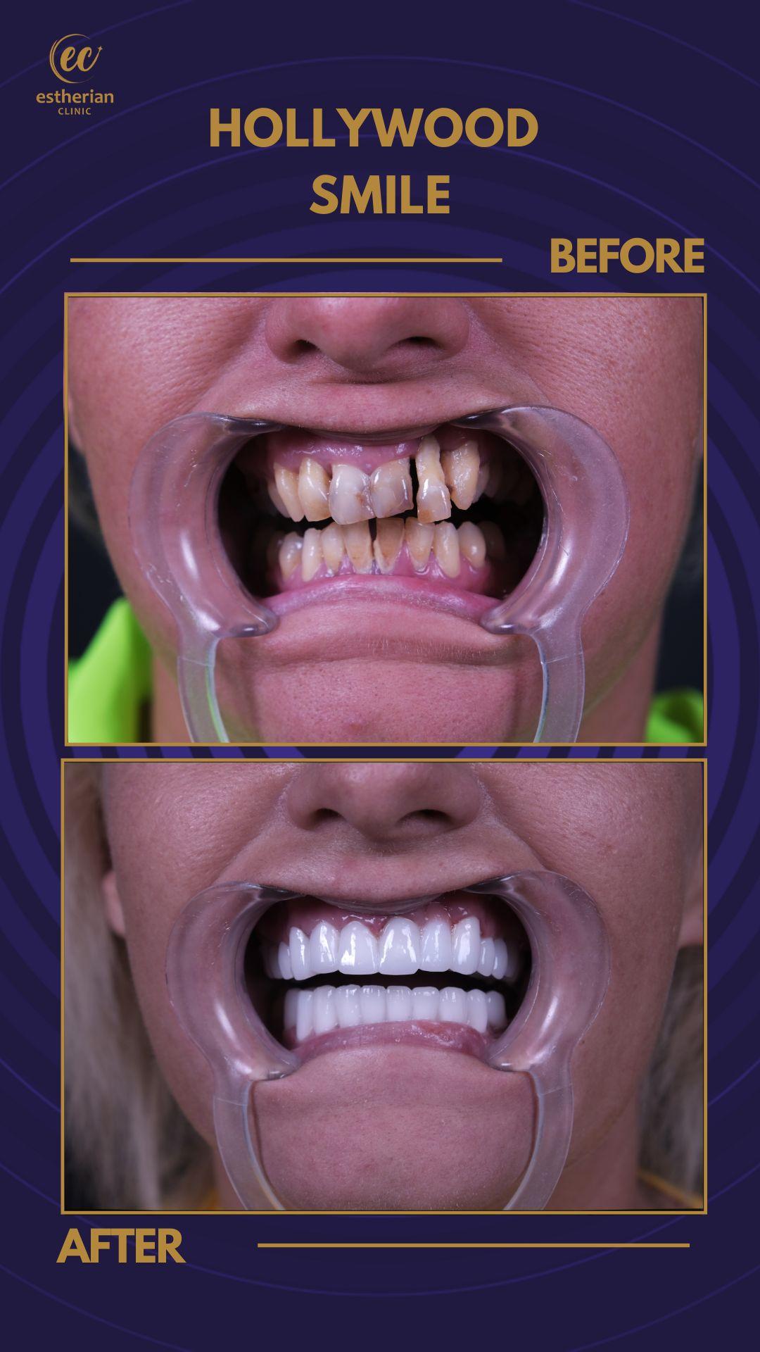 Estherian Istanbul on Esthetic Planet