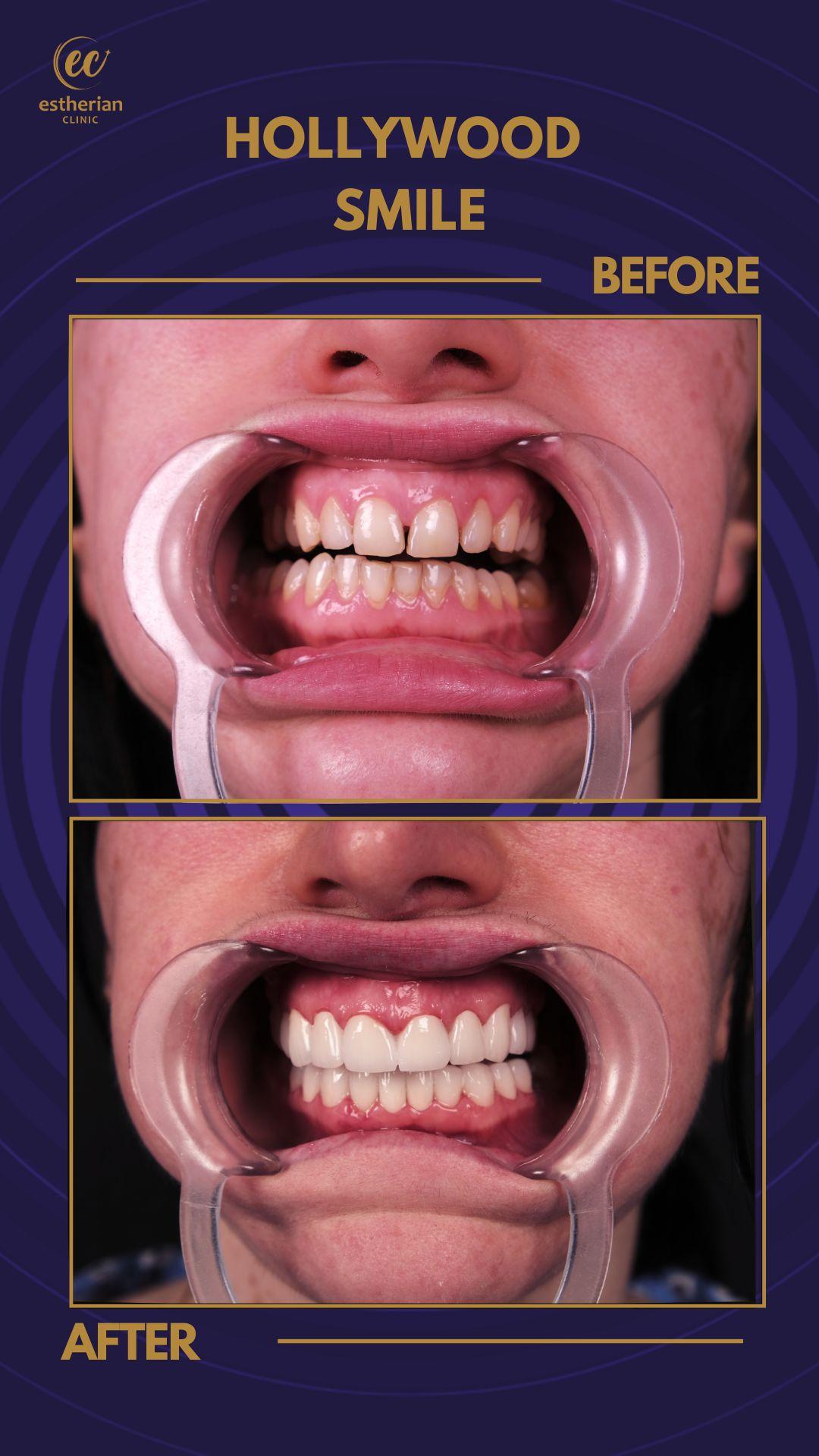 Estherian Istanbul on Esthetic Planet