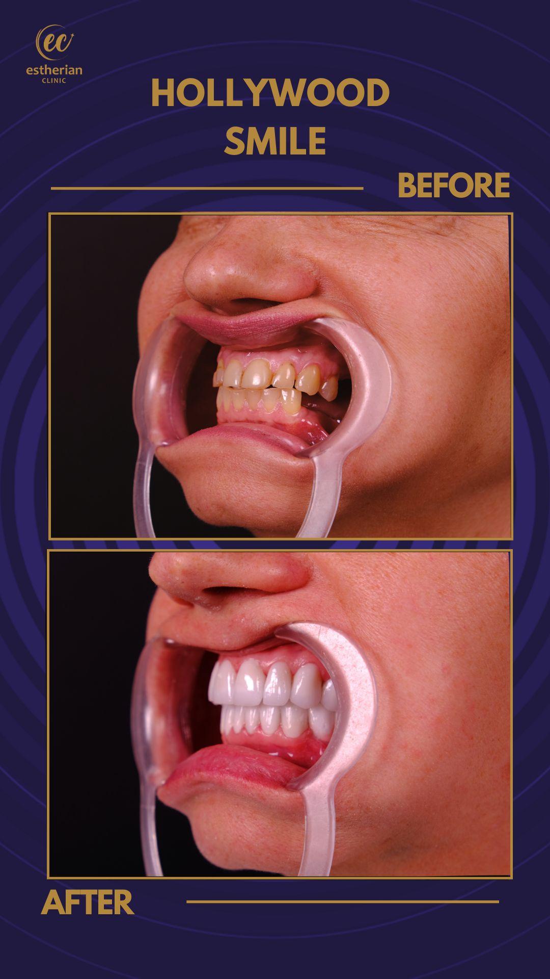 Estherian Istanbul on Esthetic Planet