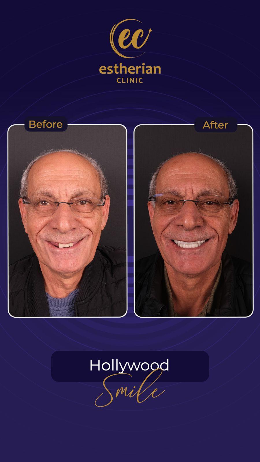 Estherian Istanbul on Esthetic Planet