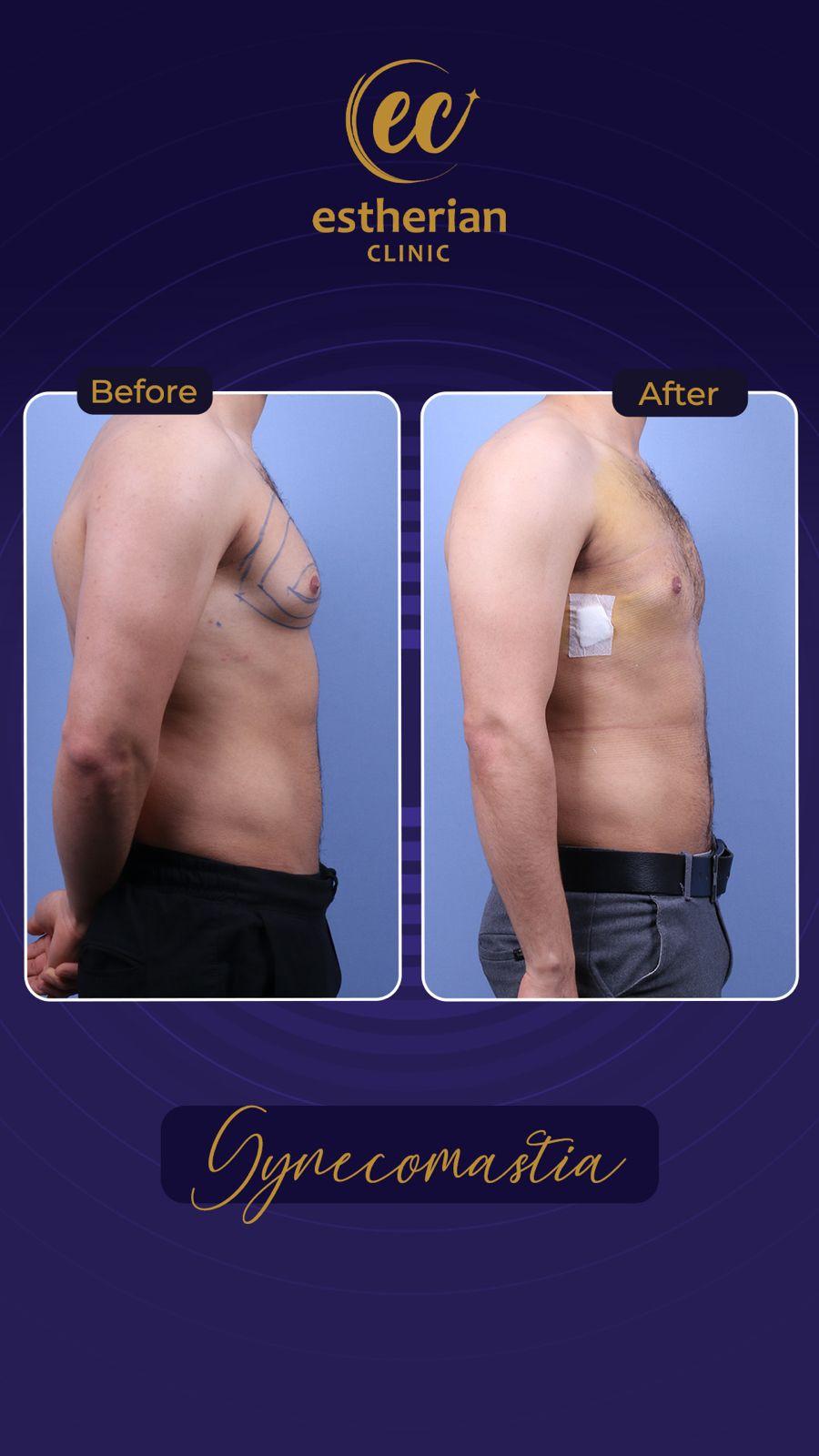 Estherian Istanbul on Esthetic Planet