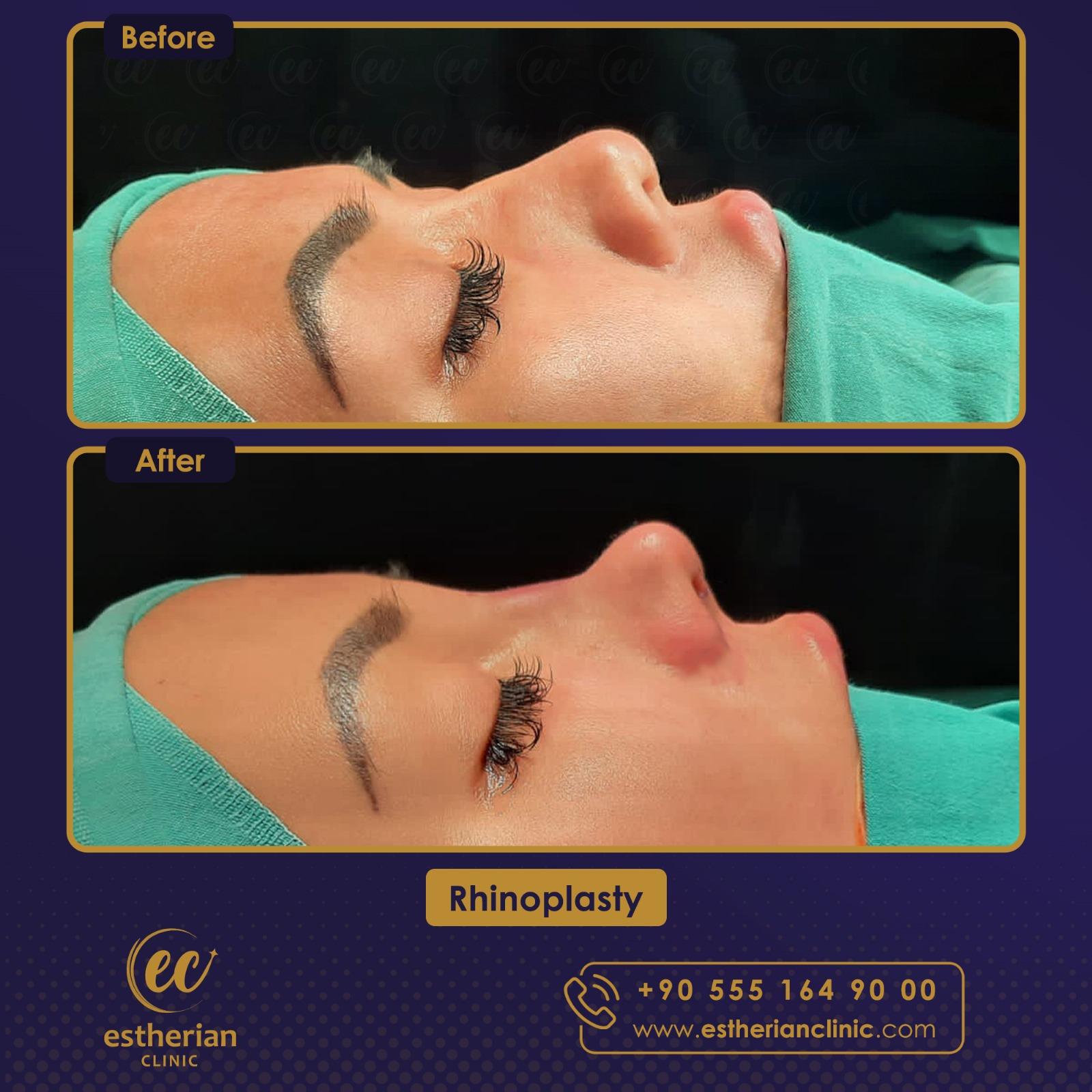 Estherian Istanbul on Esthetic Planet