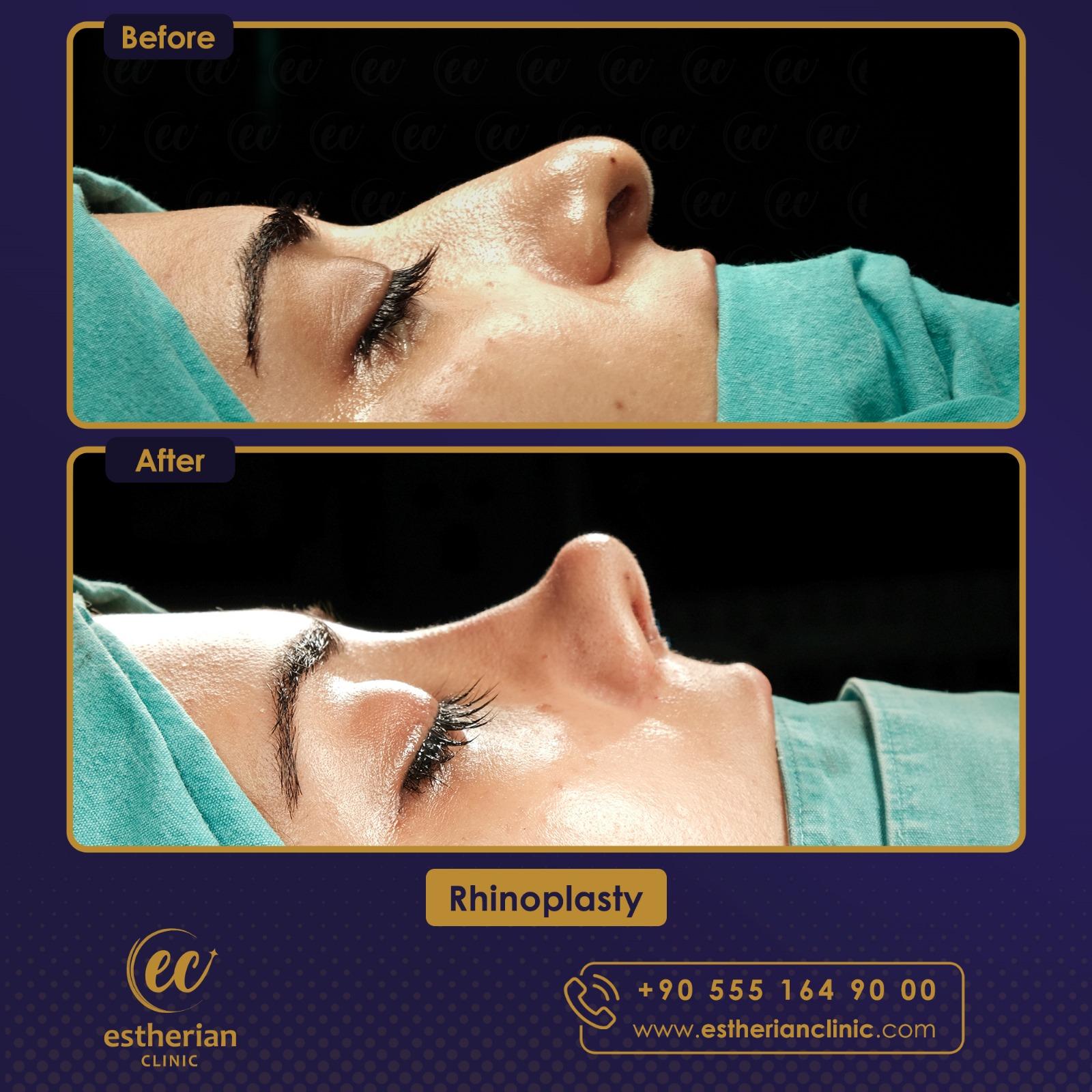 Estherian Istanbul on Esthetic Planet