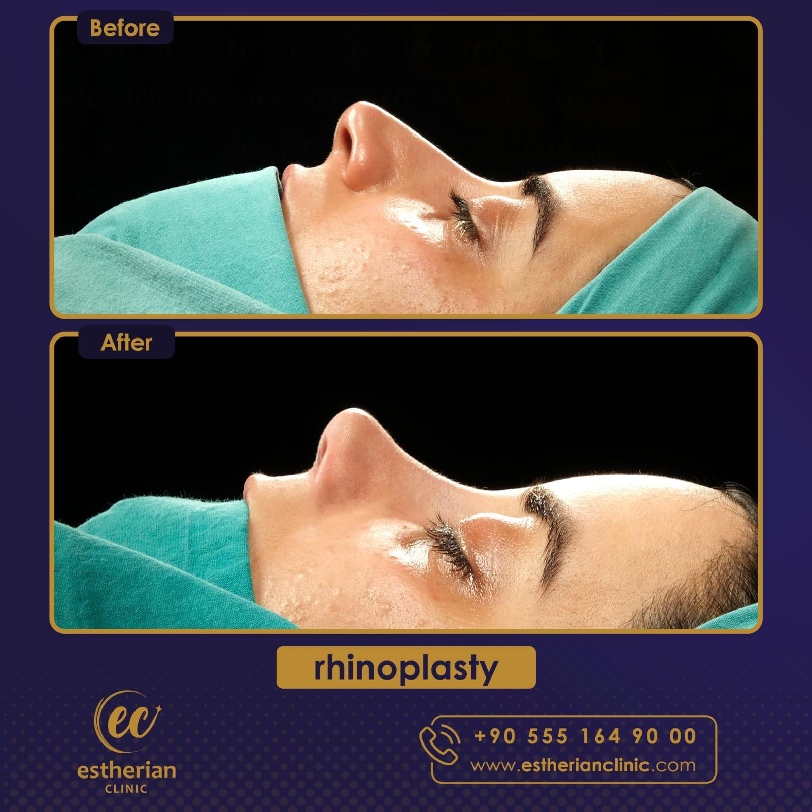 Estherian Istanbul on Esthetic Planet