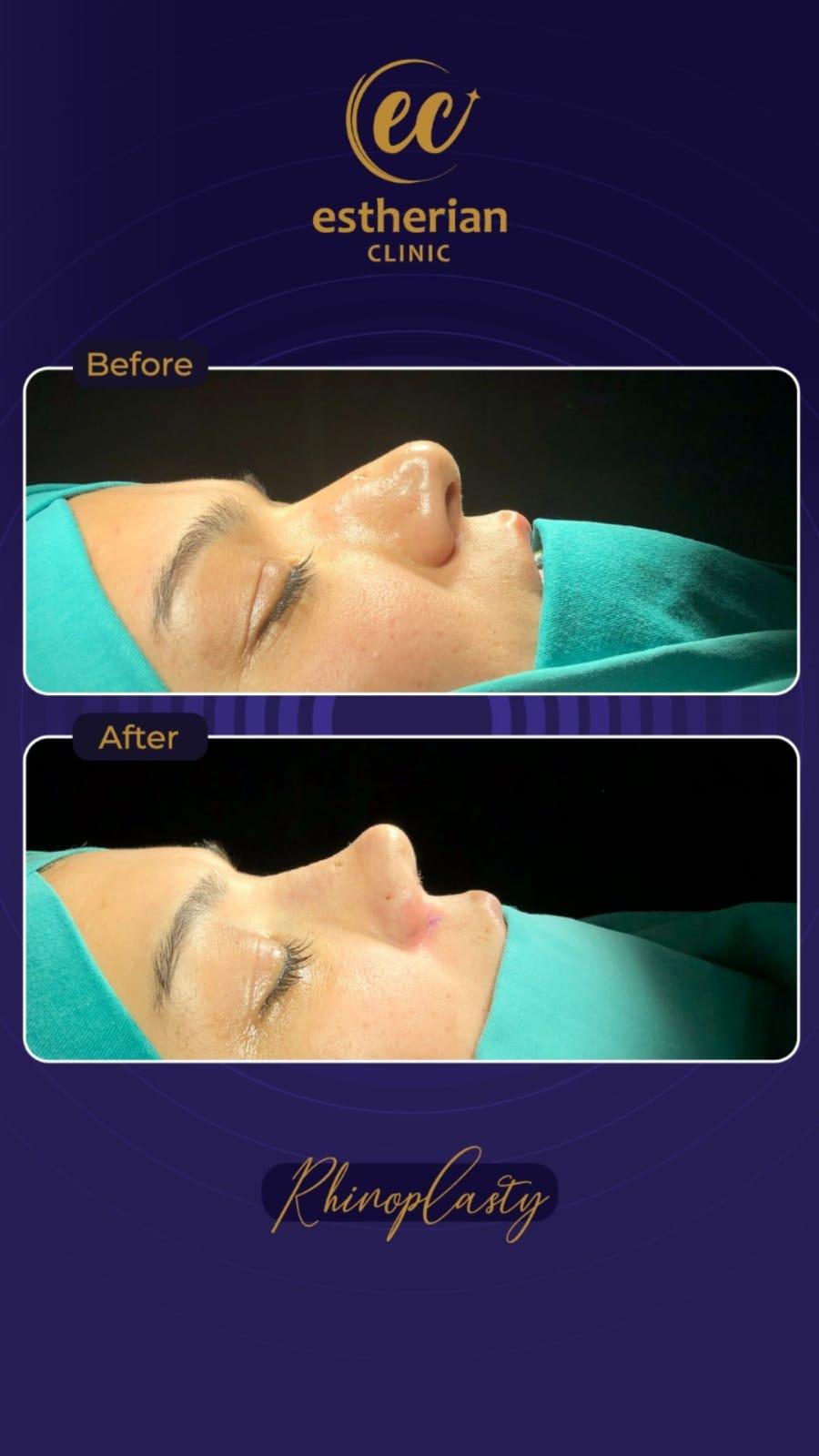 Estherian Istanbul on Esthetic Planet250212-WA0208